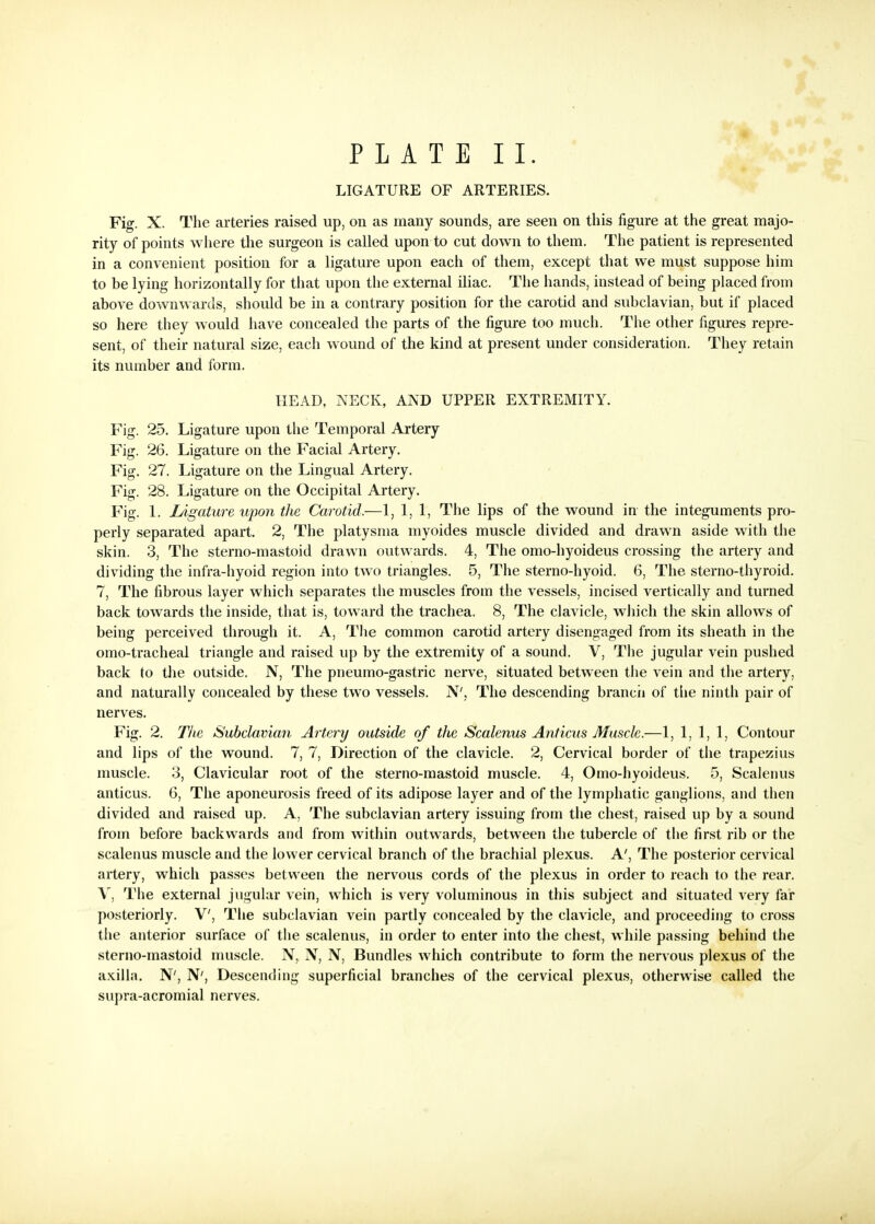 P L A T E I I. LIGATURE OF ARTERIES. Fig. X. The arteries raised up, on as many sounds, are seen on this figure at the great majo- rity of points where the surgeon is called upon to cut down to them. The patient is represented in a convenient position for a ligature upon each of them, except that we must suppose him to be lying horizontally for that upon the external iliac. The hands, instead of being placed from above downwards, should be in a contrary position for the carotid and subclavian, but if placed so here they would have concealed the parts of the figure too much. The other figures repre- sent, of their natural size, each wound of the kind at present under consideration. They retain its number and form, HEAD, NECK, AND UPPER EXTREMITY. Fig. 25. Ligature upon the Temporal Artery Fig. 26. Ligature on the Facial Artery. Fig. 27. Ligature on the Lingual Artery. Fig. 28, Ligature on the Occipital Artery. Fig. I. Ligature upon the Carotid.—1, 1, 1, The lips of the wound in the integuments pro- perly separated apart. 2, The platysma myoides muscle divided and drawn aside with the skin. 3, The sterno-mastoid drawn outwards. 4, The omo-hyoideus crossing the artery and dividing the infra-hyoid region into two triangles. 5, The sterno-hyoid. 6, The sterno-thyroid, 7, The fibrous layer which separates the muscles from the vessels, incised vertically and turned back towards the inside, that is, toward the trachea. 8, The clavicle, wliich the skin allows of being perceived through it. A, The common carotid artery disengaged from its sheath in the omo-tracheal triangle and raised up by the extremity of a sound. V, The jugular vein pushed back to tlie outside. N, The pneumo-gastric nerve, situated between the vein and the artery, and naturally concealed by these two vessels, N', The descending brancii of tlie ninth pair of nerves. Fig. 2. The Subclaviaji Artery outside of the Scalenus Anticus Muscle.—1, 1, 1, 1, Contour and lips of the wound. 7, 7, Direction of the clavicle. 2, Cervical border of the trapezius muscle. 3, Clavicular root of the sterno-mastoid muscle. 4, Omo-hyoideus. 5, Scalenus anticus. 6, The aponeurosis freed of its adipose layer and of the lymphatic ganglions, and then divided and raised up. A, The subclavian artery issuing from the chest, raised up by a sound from before backwards and from within outwards, between the tubercle of the first rib or the scalenus muscle and the lower cervical branch of the brachial plexus. A', The posterior cervical artery, which passes between the nervous cords of the plexus in order to reach to the rear. V, The external jugular vein, which is very voluminous in this subject and situated very far posteriorly. V, The subclavian vein partly concealed by the clavicle, and proceeding to cross the anterior surface of the scalenus, in order to enter into the chest, while passing behind the sterno-mastoid muscle. N, N, N, Bundles which contribute to form the nervous plexus of the axilla. N', N', Descending superficial branches of the cervical plexus, otherwise called the supra-acromial nerves.
