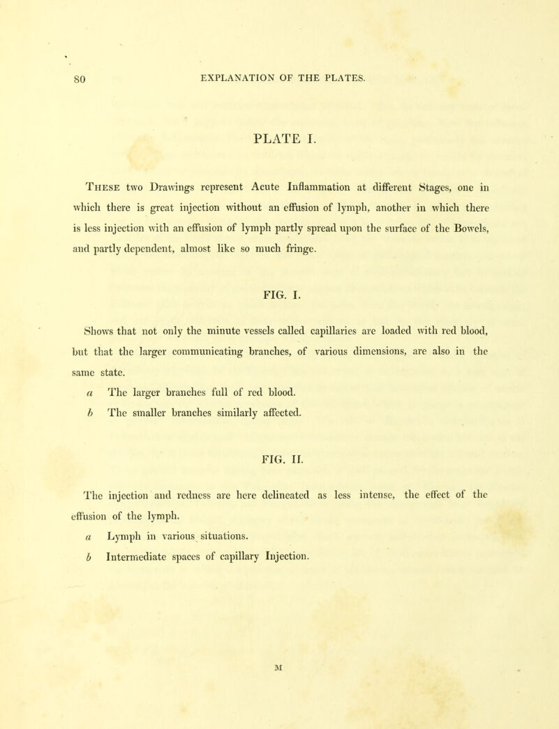 PLATE I. These two Drawings represent Acute Inflammation at different Stages, one in which there is great injection without an effusion of lymph, another in which there is less injection with an effusion of lymph partly spread upon the surface of the Bowels, and partly dependent, almost like so much fringe. FIG. I. Shows that not only the minute vessels called capillaries are loaded with red blood, but that the larger communicating branches, of various dimensions, are also in the same state. a The larger branches full of red blood. h The smaller branches similarly affected. FIG. II. I'he injection and redness are here delineated as less intense, the effect of the effusion of the lymph. a Lymph in various situations. h Intermediate spaces of capillary Injection. M