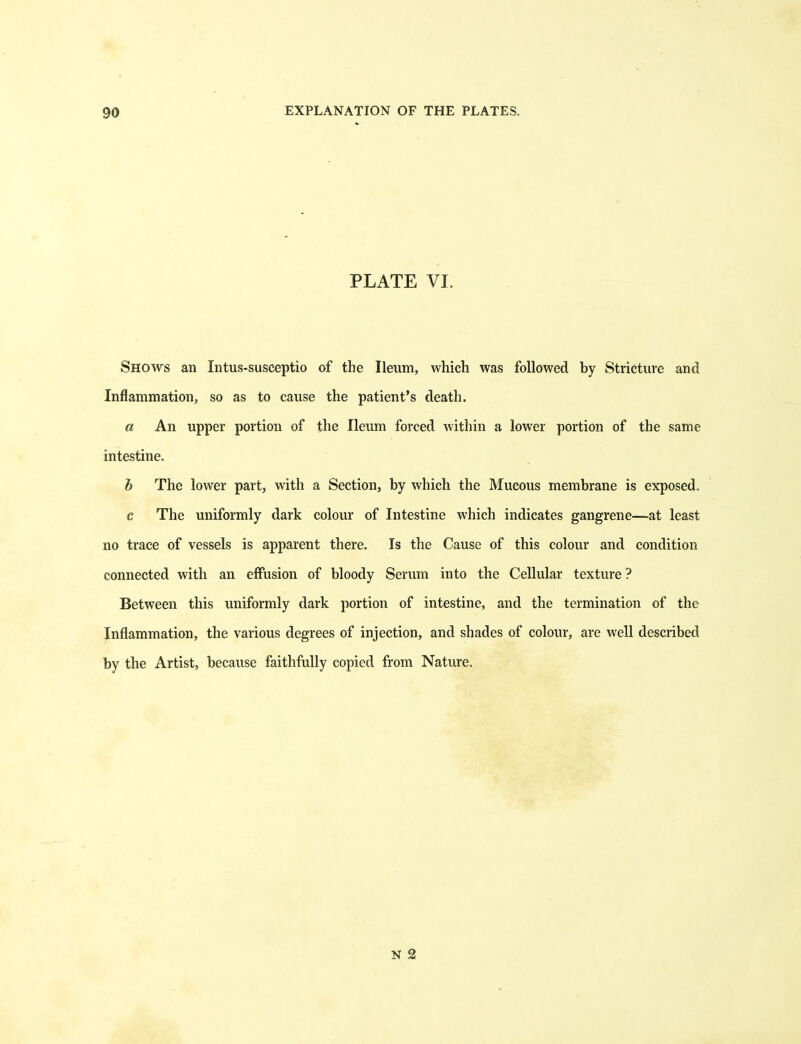 PLATE VI. Shows an Intus-susceptio of the Ileum, which was followed by Stricture and Inflammation, so as to cause the patient's death. a An upper portion of the Ileum forced within a lower portion of the same intestine. h The lower part, with a Section, by which the Mucous membrane is exposed, c The uniformly dark colour of Intestine which indicates gangrene—at least no trace of vessels is apparent there. Is the Cause of this colour and condition connected with an effusion of bloody Serum into the Cellular texture ? Between this uniformly dark portion of intestine, and the termination of the Inflammation, the various degrees of injection, and shades of colour, are well described by the Artist, because faithfully copied from Nature.