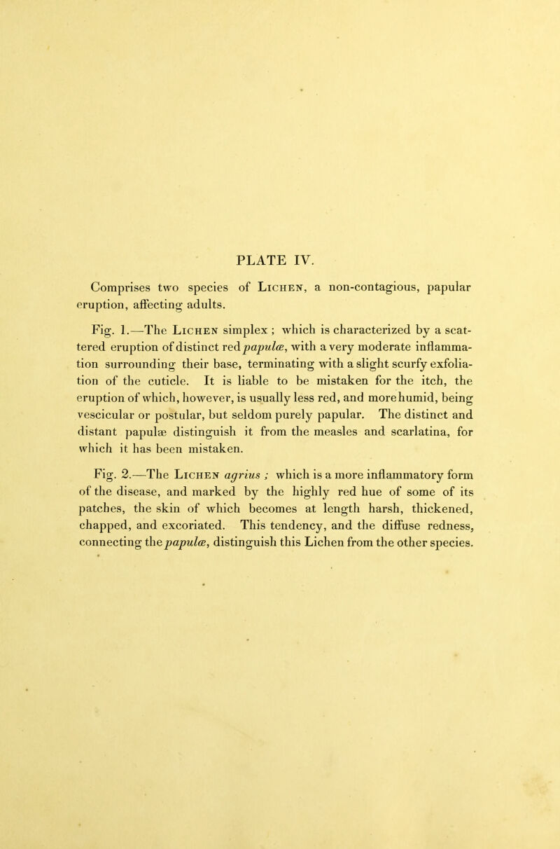 Comprises two species of Lichen, a non-contagious, papular eruption, affecting adults. Fig. L—The Lichen simplex ; which is characterized by a scat- tered eruption of distinct redpapul(jB, with a very moderate inflamma- tion surrounding their base, terminating with a slight scurfy exfolia- tion of the cuticle. It is liable to be mistaken for the itch, the eruption of which, however, is usually less red, and more humid, being vescicular or postular, but seldom purely papular. The distinct and distant papulae distinguish it from the measles and scarlatina, for which it has been mistaken. Fig. 2.—The Lichen agrius ; which is a more inflammatory form of the disease, and marked by the highly red hue of some of its patches, the skin of which becomes at length harsh, thickened, chapped, and excoriated. This tendency, and the diflPuse redness, connecting thepapulce, distinguish this Lichen from the other species.