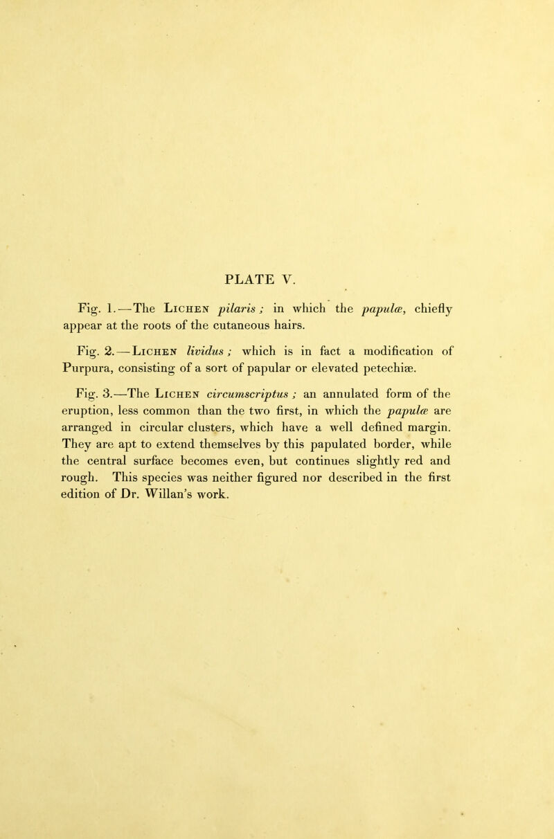 Fig. 1.—The Lichen pilaris; in which the papuloe, chiefly appear at the roots of the cutaneous hairs. Fig. 2. — Lichen lividus ; which is in fact a modification of Purpura, consisting of a sort of papular or elevated petechiae. Fig. 3.—The Lichen circumscriptus ; an annulated form of the eruption, less common than the two first, in which the papulcB are arranged in circular clusters, which have a well defined margin. They are apt to extend themselves by this papulated border, while the central surface becomes even, but continues slightly red and rough. This species was neither figured nor described in the first edition of Dr. Willan's work.