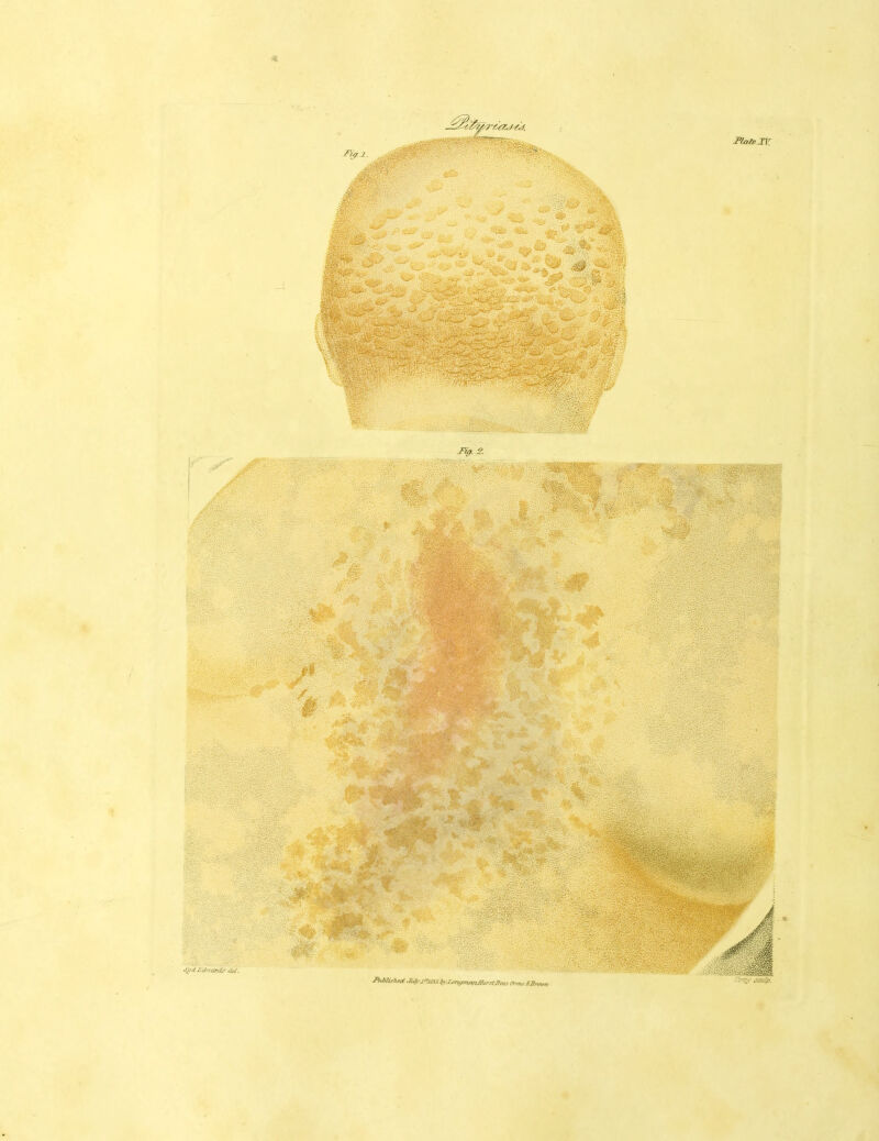 Fin. 9. lis?