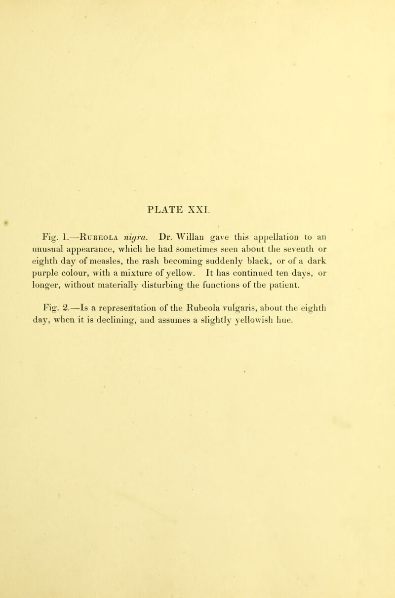 Fig. 1.—Rubeola nigra. Dr. Willan gave this appellation to an unusual appearance, which he had sometimes seen about the seventh or eighth day of measles, the rash becoming suddenly black, or of a dark purple colour, with a mixture of yellow. It has continued ten days, or longer, without materially disturbing the functions of the patient. Fig. 2.—Is a representation of the Rubeola vulgaris, about the eighth day, when it is declining, and assumes a slightly yellowish hue.
