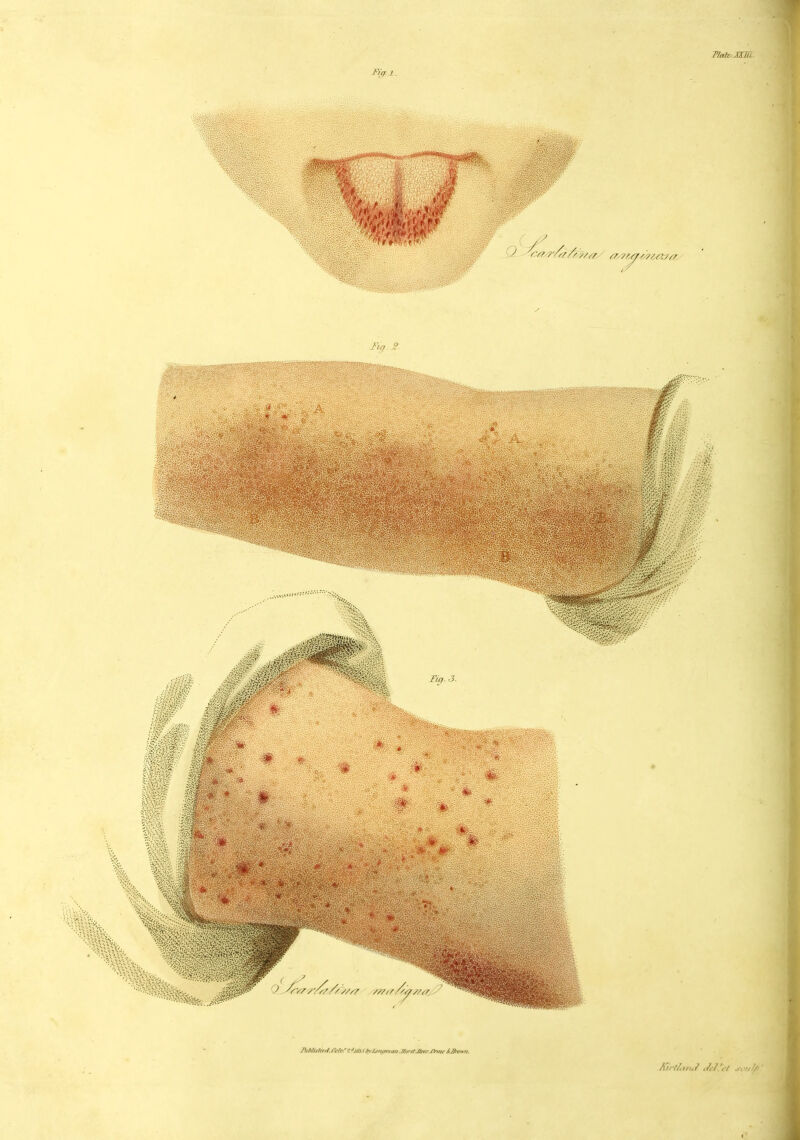 Tlafe.JXHj.. Fiff. I. /Ul//,ri,j .M.'rl .<;■!///<