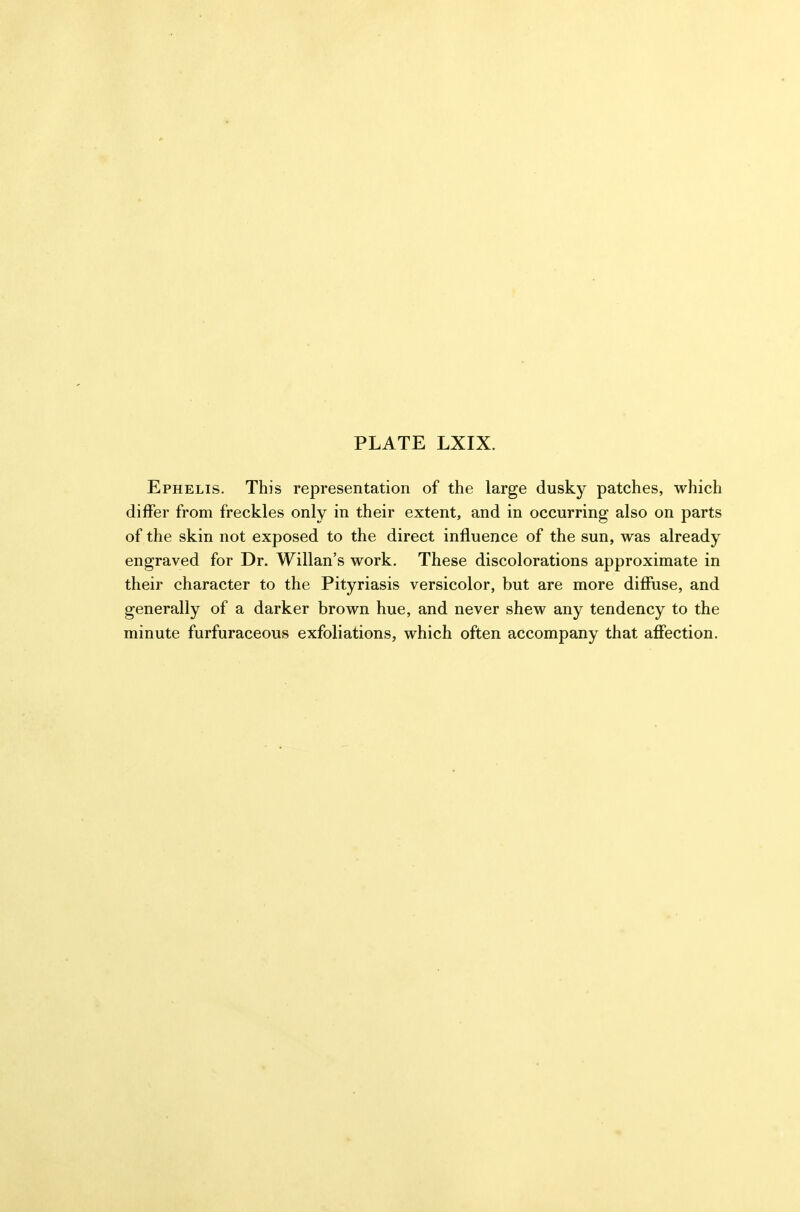 Ephelis. This representation of the large dusky patches, which differ from freckles only in their extent, and in occurring also on parts of the skin not exposed to the direct influence of the sun, was already engraved for Dr. Willan's work. These discolorations approximate in their character to the Pityriasis versicolor, but are more diffuse, and generally of a darker brown hue, and never shew any tendency to the minute furfuraceous exfoliations, which often accompany that affection.