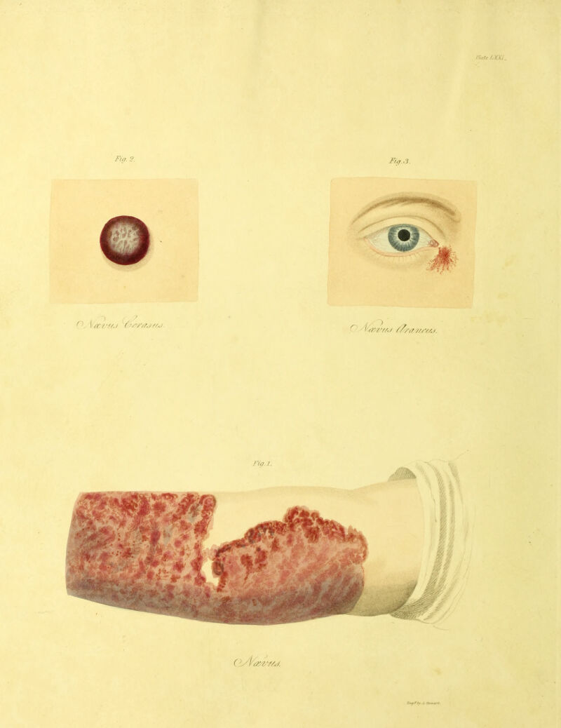 Fip. 2. Knir f hv .i. rtrirart