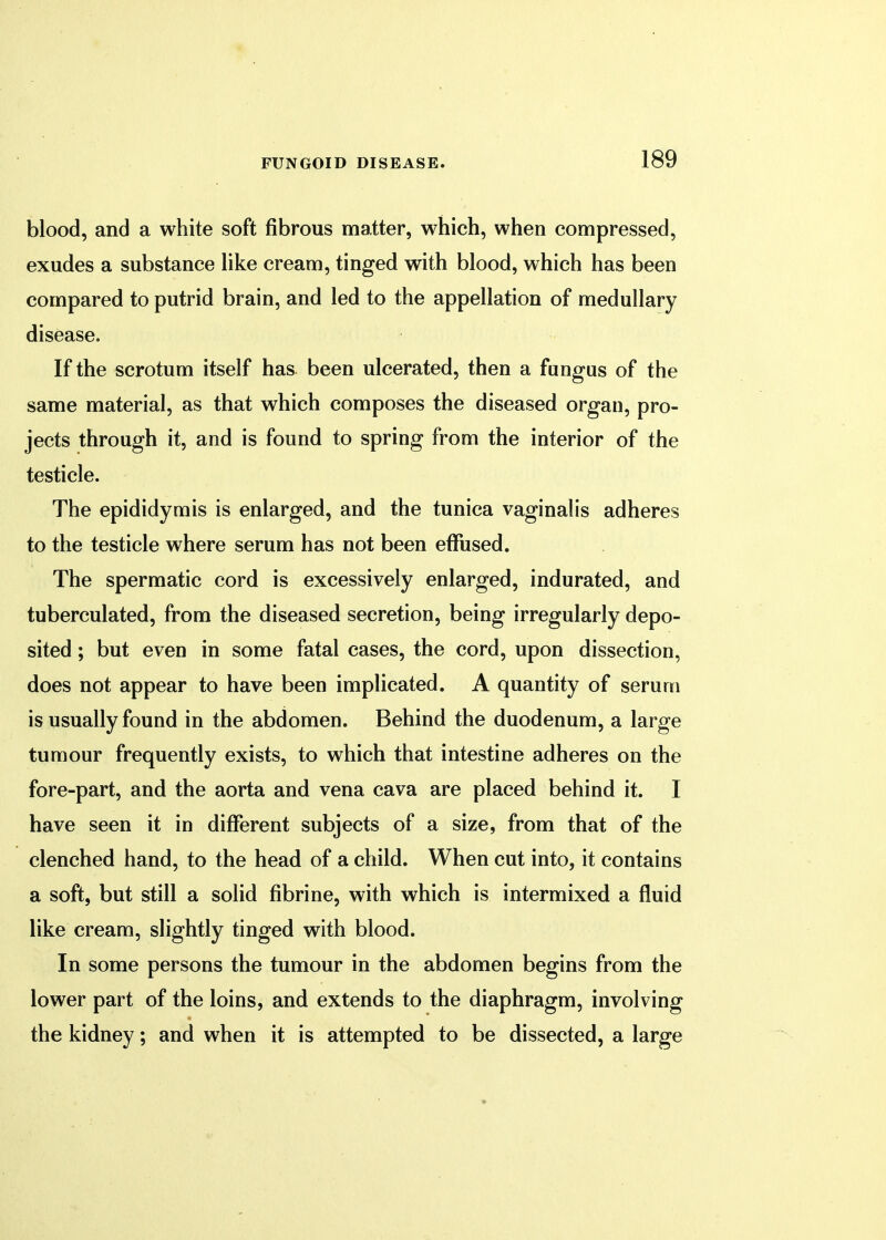 blood, and a white soft fibrous matter, which, when compressed, exudes a substance like cream, tinged with blood, which has been compared to putrid brain, and led to the appellation of medullary disease. If the scrotum itself has been ulcerated, then a fungus of the same material, as that which composes the diseased organ, pro- jects through it, and is found to spring from the interior of the testicle. The epididymis is enlarged, and the tunica vaginalis adheres to the testicle where serum has not been effused. The spermatic cord is excessively enlarged, indurated, and tuberculated, from the diseased secretion, being irregularly depo- sited ; but even in some fatal cases, the cord, upon dissection, does not appear to have been implicated. A quantity of serum is usually found in the abdomen. Behind the duodenum, a large tumour frequently exists, to which that intestine adheres on the fore-part, and the aorta and vena cava are placed behind it. I have seen it in different subjects of a size, from that of the clenched hand, to the head of a child. When cut into, it contains a soft, but still a solid fibrine, with which is intermixed a fluid like cream, slightly tinged with blood. In some persons the tumour in the abdomen begins from the lower part of the loins, and extends to the diaphragm, involving the kidney; and when it is attempted to be dissected, a large