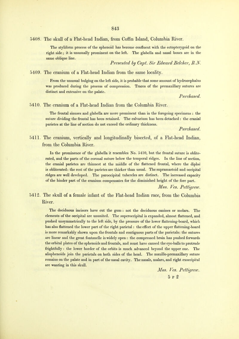 5408. The skull of a Flat-head Indian, from Coffin Island, Columbia River. The styliform process of the sphenoid has hecome confluent with the ectopterygoid on the right side; it is unusually prominent on the left. The glabella and nasal bones are in the same oblique line. Presented hy Capt. Sir Edward Belcher, B.N. 5409. The cranium of a Flat-head Indian from the same locality. From the unusual bulging on the left side, it is probable that some amount of hydrocephalus was produced during the process of compression. Traces of the premaxillary sutures are distinct and extensive on the palate. Purchased. 5410. The cranium of a Flat-head Indian from the Columbia River. The frontal sinuses and glabella are more prominent than in the foregoing specimens : the suture dividing the frontal has been retained. The calvarium has been detached : the cranial parietes at the hne of section do not exceed the ordinary thickness. Purchased. 5411. The cranium, vertically and longitudinally bisected, of a Flat-head Indian, from the Columbia River. In the prominence of the glabella it resembles No. 5410, but the frontal suture is oblite- rated, and the parts of the coronal suture below the temporal ridges. In the line of section, the cranial parietes are thinnest at the middle of the flattened frontal, where the diploe is obliterated: the rest of the parietes are thicker than usual. The supramastoid and occipital ridges are well developed. The paroccipital tubercles are distinct. The increased capacity of the hinder part of the cranium compensates for the diminished height of the fore part. Mus. Ves. Pettigreio. 5412. The skull of a female infant of the Flat-head Indian race, from the Columbia River. The deciduous incisors have cut the gum : not the deciduous canines or molars. The elements of the occipital are ununited. The superoccipital is expanded, almost flattened, and pushed unsymmetrically to the left side, by the pressure of the lower flattening-board, which has also flattened the lower part of the right parietal: the effect of the upper flattening-board is more remarkably shown upon the frontals and contiguous parts of the parietals: the sutures are linear and the great fontanelle is widely open : the compressed brain has pushed forwards the orbital plates of the sphenoids and frontals, and must have caused the eye-balls to protrude frightfully: the lower border of the orbits is much advanced beyond the upper one. The alisphenoids join the parietals on both sides of the head. The maxillo-premaxillary suture remains on the palate and in part of the nasal cavity. The nasals, malars, and right exoccipital are wanting in this skull. Mus. Ves. Pettigrew. 5 p 2