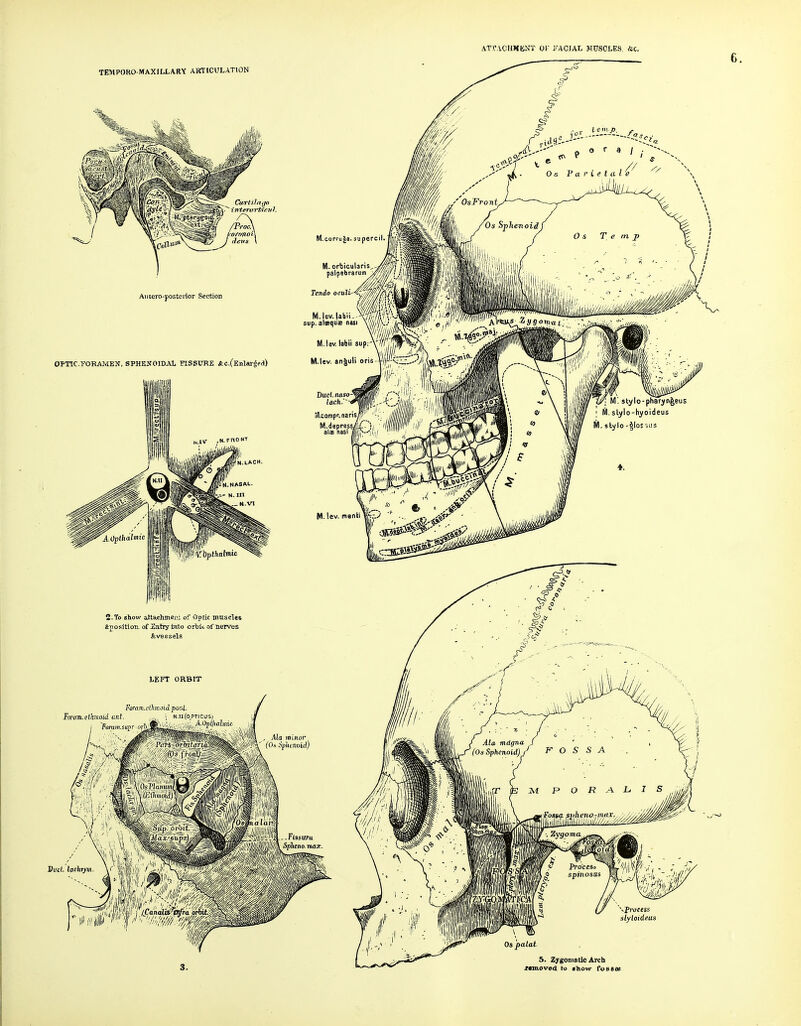 ATTAOHMEST Or l''ACIAt, MUSCLES Ac. TEMPORO-MAXILLARY AHTICULATION \Profess slyloideus Os palat 5. Zygomatic Arch xamoved to ihow fossee