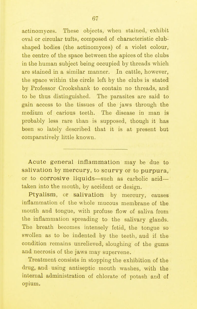 actinomyces. These objects, wheu stained, exhibit oval or circular tufts, composed of characteristic club- shaped bodies (the actinomyces) of a violet colour, the centre of the space between the apices of the clubs in the human subject being occupied by threads which are stained in a similar manner. In cattle, however, the space within the circle left by the clubs is stated by Professor Crookshank to contain no threads, and to be thus distinguished. The parasites are said to gain access to the tissues of the jaws through the medium of carious teeth. The disease in man is probably less rare than is supposed, though it has been so lately described that it is at present but comparatively little known. Acute general inflammation may be due to salivation by mercury, to scurvy or to purpura, or to corrosive liquids—such as carbolic acid— taken into the mouth, by accident or design. Ptyalism, or salivation by mercury, causes inflammation of the whole mucous membrane of the mouth and tongue, with profuse flow of saliva from the inflammation spreading to the salivary glands. The breath becomes intensely fetid, the tongue so swollen as to be indented by the teeth, aud if the condition remains unrelieved, sloughing of the gums and necrosis of the jaws may supervene. Treatment consists in stopping the exhibition of the drug, and using antiseptic mouth washes, with the internal administration of chlorate of potash and of opium.