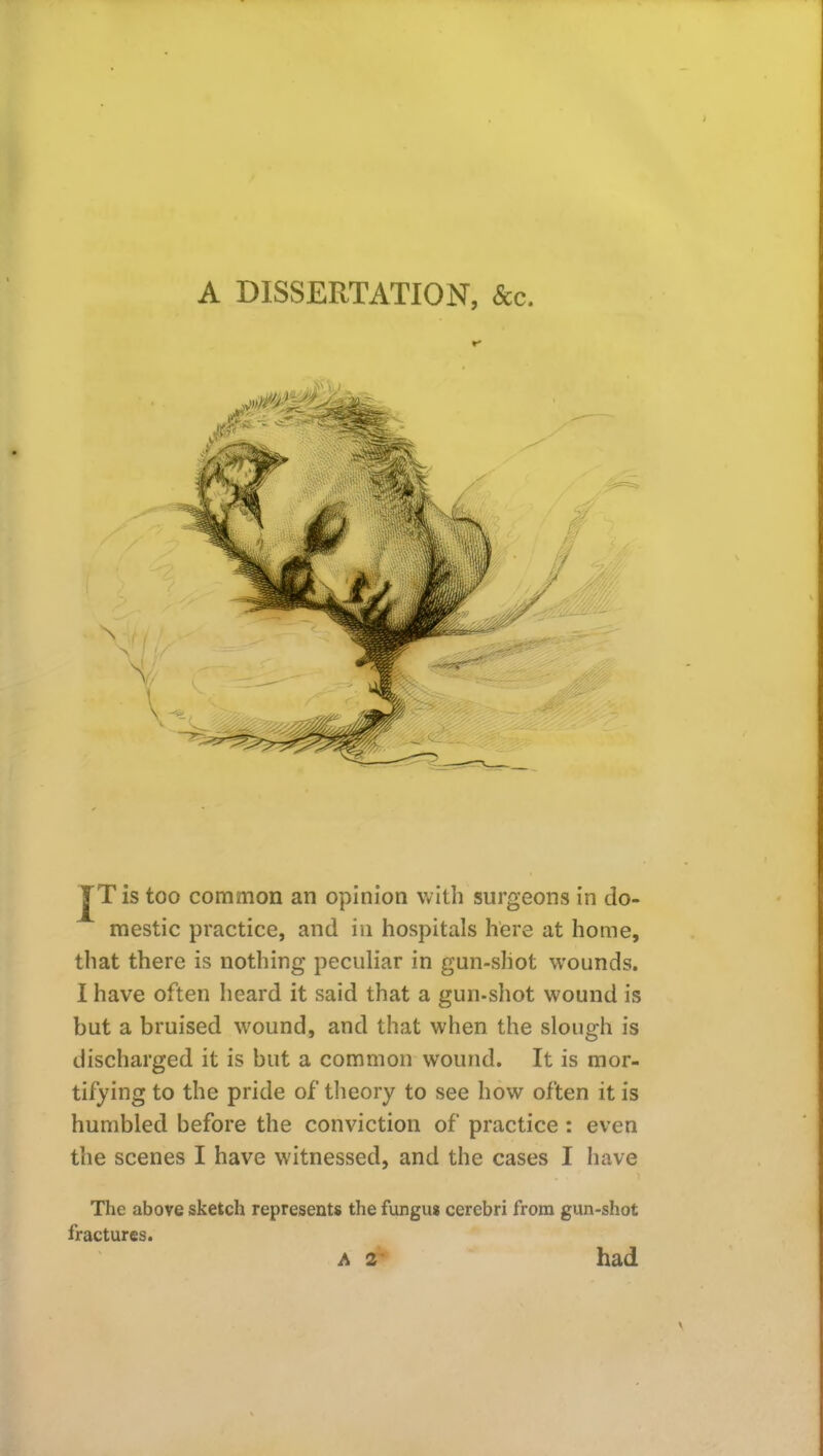 A DISSERTATION, &c. JTis too common an opinion with surgeons in do- mestic practice, and in hospitals here at home, that there is nothing peculiar in gun-shot wounds. I have often heard it said that a gun-shot wound is but a bruised wound, and that when the slough is discharged it is but a common wound. It is mor- tifying to the pride of theory to see how often it is humbled before the conviction of practice : even the scenes I have witnessed, and the cases I have The above sketch represents the fungus cerebri from gun-shot fractures. A 2' had