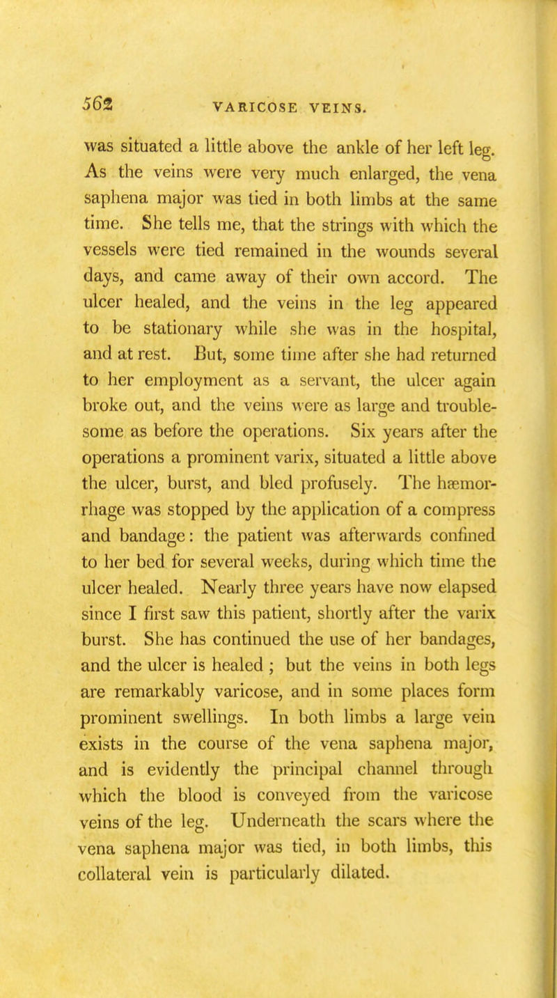 was situated a little above the ankle of her left leg. As the veins were very much enlarged, the vena saphena major was tied in both limbs at the same time. She tells me, that the strings with which the vessels were tied remained in the wounds several days, and came away of their own accord. The ulcer healed, and the veins in the leg appeared to be stationary while she was in the hospital, and at rest. But, some time after she had returned to her employment as a servant, the ulcer again broke out, and the veins were as large and trouble- some as before the operations. Six years after the operations a prominent varix, situated a little above the ulcer, burst, and bled profusely. The haemor- rhage was stopped by the application of a compress and bandage: the patient was afterwards confined to her bed for several weeks, during which time the ulcer healed. Nearly three years have now elapsed since I first saw this patient, shortly after the varix burst. She has continued the use of her bandages, and the ulcer is healed ; but the veins in both legs are remarkably varicose, and in some places form prominent swellings. In both limbs a large vein exists in the course of the vena saphena major, and is evidently the principal channel through which the blood is conveyed from the varicose veins of the leg. Underneath the scars where the vena saphena major was tied, in both limbs, this collateral vein is particularly dilated.