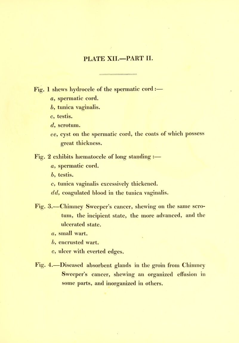 J PLATE XII.—PART II. 1 shews hydrocele of the spermatic cord :— fl, spermatic cord. Z>, tunica vaginalis, c, testis, scrotum. ee, cyst on the spermatic cord, the coats of which possess great thickness. 2 exhibits haematocele of long standing :— a, spermatic cord. Z>, testis. c, tunica vaginalis excessively thickened. dd, coagulated blood in the tunica vaginalis. 3. —Chimney Sweeper's cancer, shewing on the same scro- tum, the incipient state, the more advanced, and the ulcerated state. «, small wart. Z>, encrusted wart, c, ulcer with everted edges. 4. —Diseased absorbent glands in the groin from Chimney Sweeper's cancer, shewing an organized effusion in some parts, and inorganized in others.