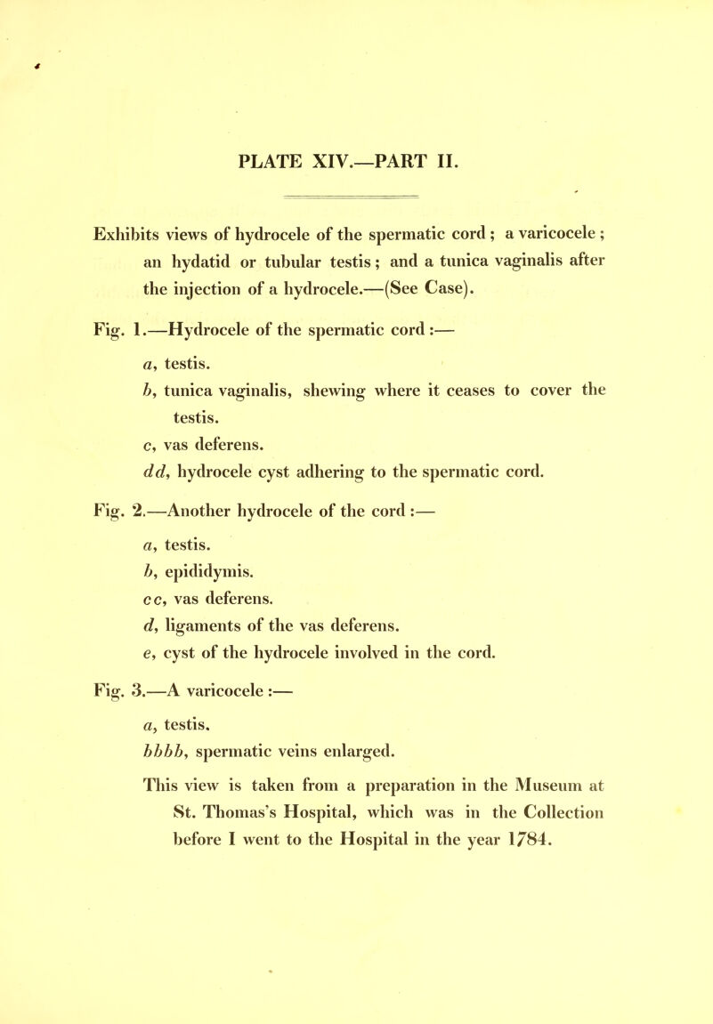* PLATE XIV.—PART II. Exhibits views of hydrocele of the spermatic cord ; a varicocele ; an hydatid or tubular testis; and a tunica vaginalis after the injection of a hydrocele.—(See Case). Fig. 1.—Hydrocele of the spermatic cord :— a, testis. Z>, tunica vaginalis, shewing where it ceases to cover the testis, c, vas deferens. dd^ hydrocele cyst adhering to the spermatic cord. Fig. 2.—Another hydrocele of the cord :— testis. Z>, epididymis, cc, vas deferens, d^ ligaments of the vas deferens, e, cyst of the hydrocele involved in the cord. Fig. 3.—A varicocele :— <2, testis. hbhh, spermatic veins enlarged. This view is taken from a preparation in the Museum at St. Thomas's Hospital, which was in the Collection
