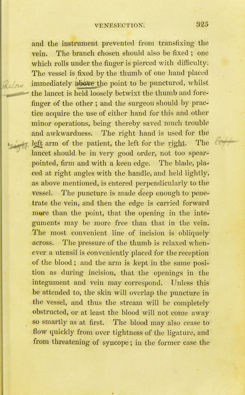 and the instrument prevented from transfixing the vein. The branch chosen should also be fixed ; one which rolls under the finger is pierced with difficulty. The vessel is fixed by the thumb of one hand placed immediately abofee; the point to be punctured, whilst the lancet is held loosely betwixt the thumb and fore- finger of the other ; and the surgeon should by prac- tice acquire the use of either hand for this and other minor operations, being thereby saved much trouble and awkwardness. The right hand is used for the left arm of the patient, the left for the righl. The lancet should be in very good order, not too spear- pointed, firm and with a keen edge. The blade, pla- ced at right angles with the handle, and held lightly, as above mentioned, is entered perpendicularly to the vessel. The puncture is made deep enough to pene- trate the vein, and then the edge is carried forward more than the point, that the opening in the inte- guments may be more free than that in the vein. The most convenient line of incision is obliquely across. The pressure of the thumb is relaxed when- ever a utensil is conveniently placed for the reception of the blood; and the arm is kept in the same posi- tion as during incision, that the openings in the integument and vein may correspond. Unless this be attended to, the skin will overlap the puncture in the vessel, and thus the stream will be completely obstructed, or at least the blood will not come away so smartly as at first. The blood may also cease to flow quickly from over tightness of the ligature, and from threatening of syncope; in the former case the