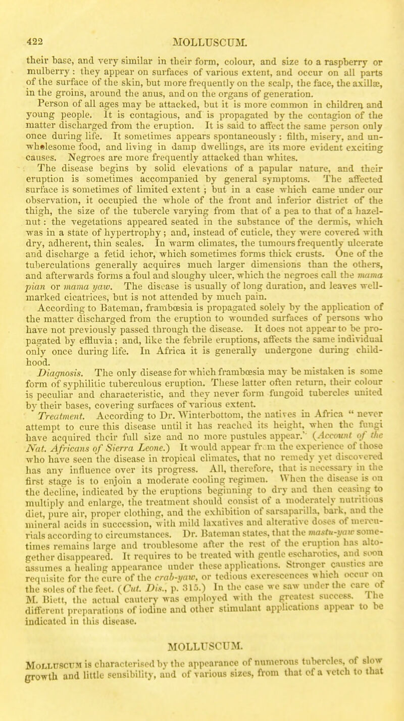 their base, and very similar in their form, colour, and size to a raspberry or mulberry: they appear on surfaces of various extent, and occur on all parts of the surface of the skin, but more frequently on the scalp, the face, the axillae, in the groins, around the anus, and on the organs of generation. Person of all ages may be attacked, but it is more common in children and young people. It is contagious, and is propagated by the contagion of the matter discharged from the eruption. It is said to affect the same person only once during life. It sometimes appears spontaneously : filth, misery, and un- Tvhelesome food, and living in damp dwellings, are its more evident exciting causes. Negroes are more frequently attacked than -whites. The disease begins by solid elevations of a papular nature, and their eruption is sometimes accompanied by general symptoms. The affected surface is sometimes of limited extent ; but in a case which came under our observation, it occupied the whole of the front and inferior district of the thigh, the size of the tubercle varying from that of a pea to that of a hazel- nut : the vegetations appeared seated in the substance of the dermis, which was in a state of hypertrophy ; and, instead of cuticle, they were covered with dry, adherent, thin scales. In warm climates, the timiours frequently ulcerate and discharge a fetid ichor, which sometimes forms thick crusts. One of the tuberculations generally acquires much larger dimensions than the others, and afterwards forms a foul and sloughy ulcer, which the negroes call the niama pian or mama yaw. The disease is usually of long duration, and leaves well- marked cicatrices, but is not attended by much pain. According to Bateman, framboesia is propagated solely by the application of the matter discharged from the eruption to wounded surfaces of persons who have not previously passed through the disease. It does not appear to be pro- pagated by effluvia ; and, like the febrile eruptions, affects the same individual only once during life. In Africa it is generally undergone during child- hood. Diagnosis. The only disease for which framboesia may be mistaken is some form of syphilitic tuberculous eruption. These latter often return, their colour is peculiar and characteristic, and they never form fungoid tubercles united by their bases, covering surfaces of various extent. Treatment. According to Dr. Winterbottom, the natives in Africa  never attempt to cure this disease until it has reached its height, when the fungi have acquired their full size and no more pustules appear.'' {Account of tlic Nat. Africans of Sierra Leone.) It would appear fi\ m the experience of those who have seen the disease in tropical climates, that no remedy yet discovered has any influence over its progress. All, therefore, that is necessary in the first stage is to enjoin a moderate cooling regimen. When the disease is on the decline, indicated by the eruptions beginning to dry and then ceasing to midtiply and enlarge, the treatment should consist of a moderately nutritious diet, pure air, proper clothing, and the exhibition of sarsaparilla, bark, and the mineral acids in succession, with mild laxatives and alterative doses of tiicrcu- rials according to circumstances. Dr. Bateman states, that the mastii-t/aw some- times remains large and troublesome after the rest of the eruption has alto- gether disappeared. It requires to be treated with gentle escharotics, and soon assumes a healing appearance under these applications. Stronger caustics arc requisite for the cure of the crab-yaw, or tedious excrescences which occur on the soles of the feel. {Cut. Dis., p. 315.) In the case we saw tmder the care of M. Biett, the actual cautery was employed with the greatest success. Ihe different preparations of iodine and other stimulant applications appear to be indicated in this disease. MOLLUSCUM. MoLLUSCUM is characterised bv the appearance of numerous tubercles, of slow growth and little sensibility, and of various sizes, from that of a vetch to that