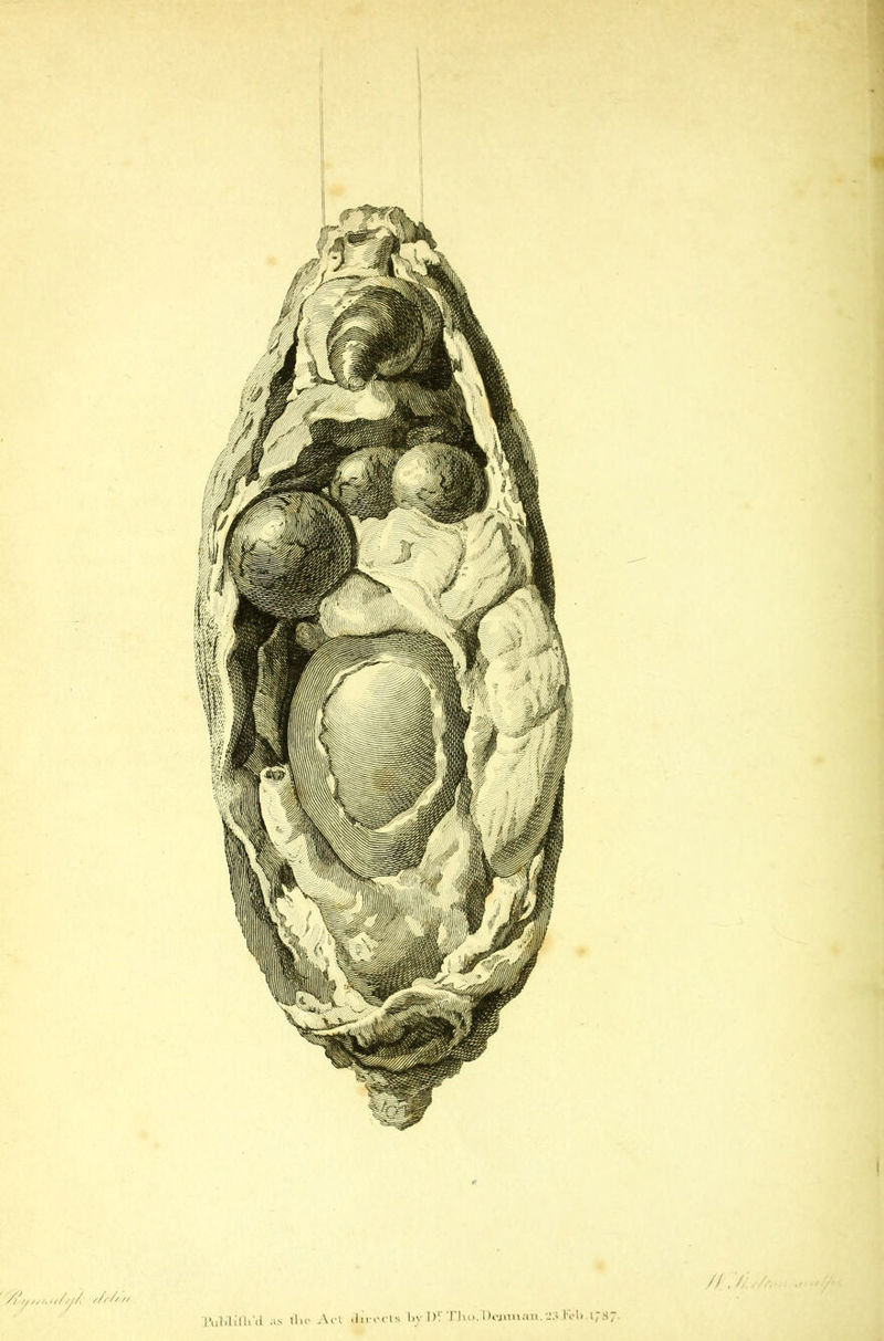 /) ////A ////// f/fbn. TUMUlt'd as the Act illl-eels l.v D! TJio.Dcjimau. -3 Ivl. .1/87 // , '/}.