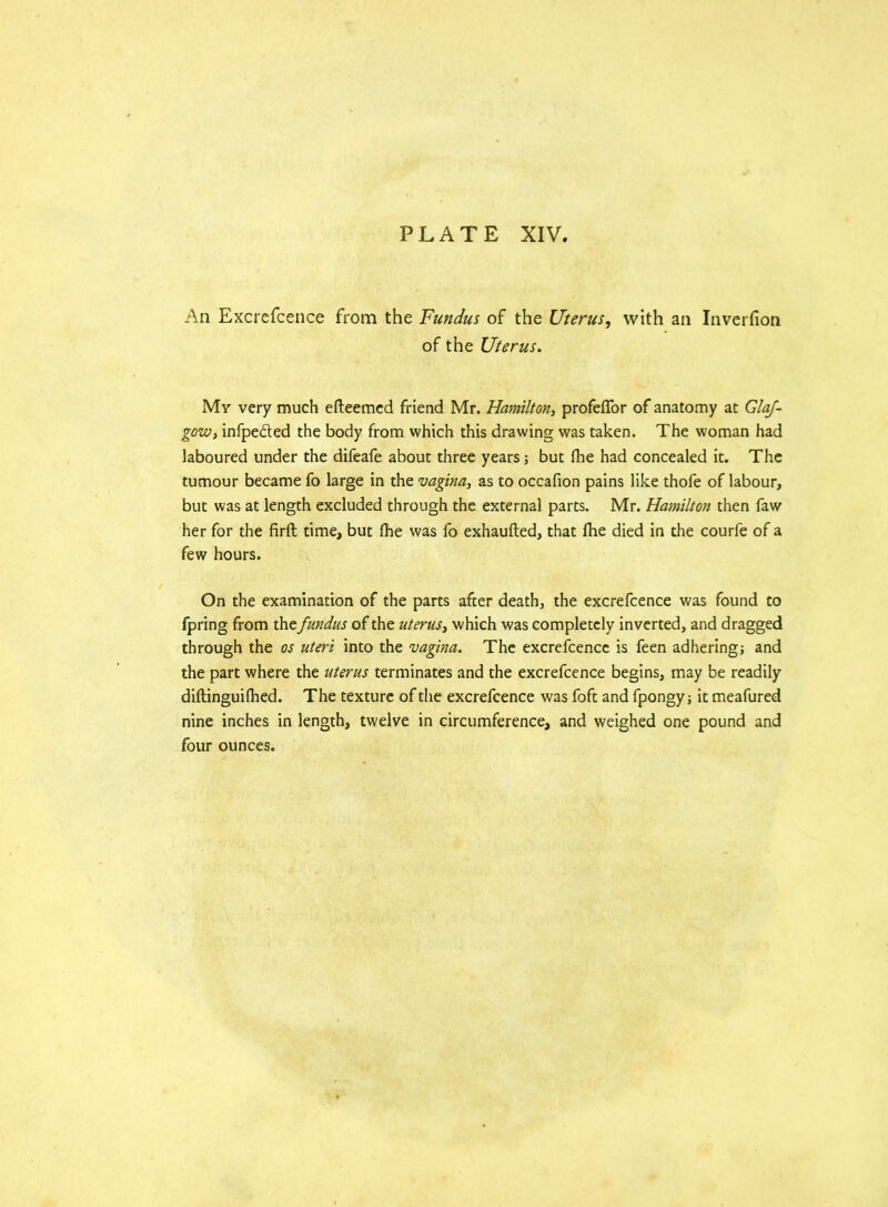 An Excrefcence from the Fundus of the Uterus, with an Inversion of the Uterus. My very much efteemed friend Mr. Hamilton, profefTor of anatomy at Glaf- gow> infpedted the body from which this drawing was taken. The woman had laboured under the difeafe about three years; but fhe had concealed it. The tumour became fo large in the vagina, as to occafion pains like thofe of labour, but was at length excluded through the external parts. Mr. Hamilton then faw her for the firft time, but fhe was fo exhaufted, that fhe died in the courfe of a few hours. On the examination of the parts after death, the excrefcence was found to fpring from the fundus of the uteruSy which was completely inverted, and dragged through the os uteri into the vagina. The excrefcence is feen adheringj and the part where the uterus terminates and the excrefcence begins, may be readily diflinguifhed. The texture of the excrefcence was foft and fpongy; it meafured nine inches in length, twelve in circumference, and weighed one pound and four ounces.