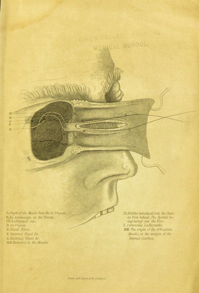 Ax^rigm ot'Oie Muscle from the Os Unguis. 3.1ts termination at the Fioicta- CCXaeJuymal Sac. ~D.Os l^ujuis. TLlfasal Utrvt. F. Internal Kasal do. G External Hasal do. TULBrtauhes to the Mvscle- WJiristles introduced into the Pwic- -ta from behind.The Eyelids b(- -ing turned over tluJose. L Cantnada Zachrj-maUs. MM. Vu origin of the Orbicularis Muscle, at the margin of the Internal Canthus- Pratm iWdXngria-tdby JJtrqytim.