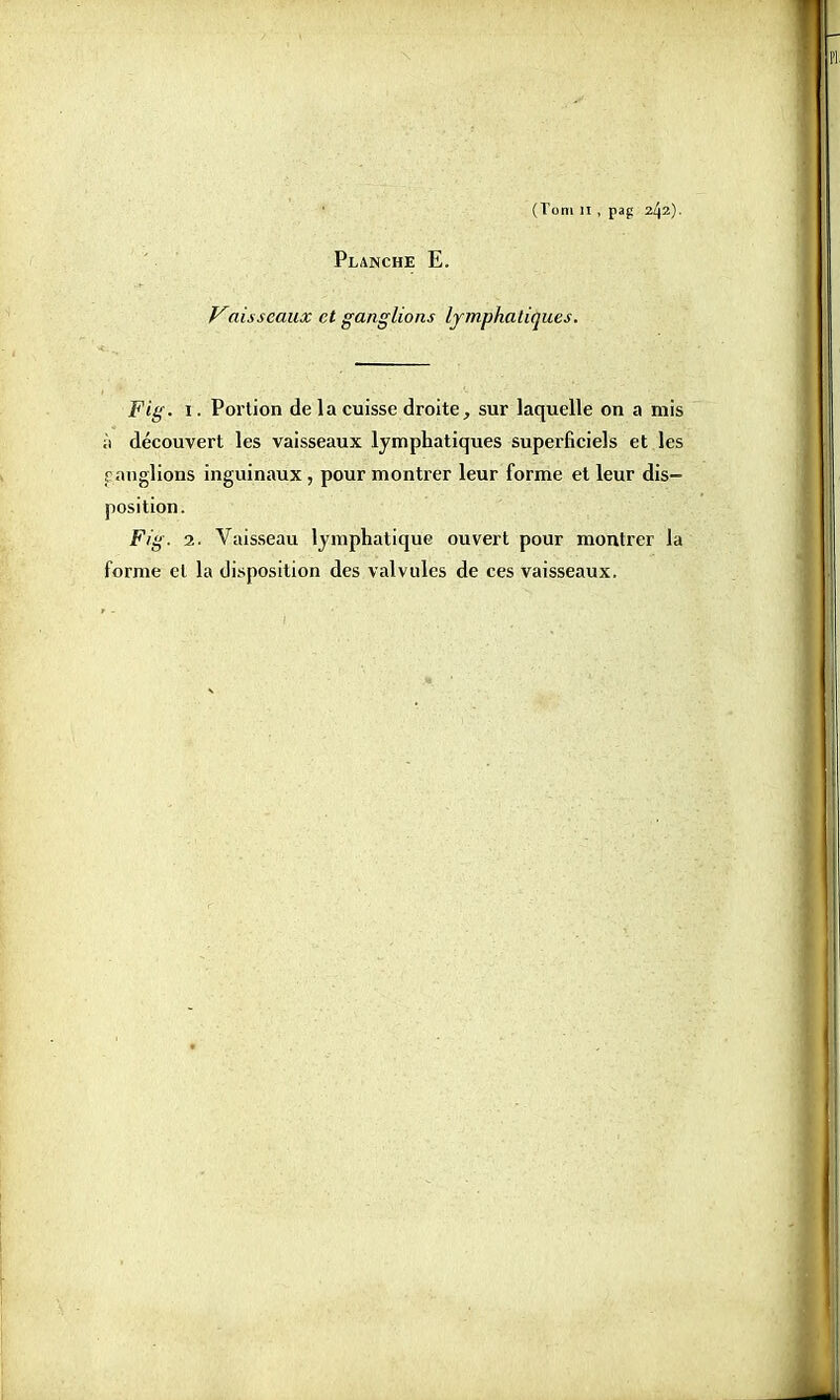 (Toni II , pap 242). Planche E. Vaisseaux et ganglions lymphatiques. Fig. 1. Portion de la cuisse droite, sur laquelle on a mis à découvert les vaisseaux lymphatiques superficiels et les f anglions inguinaux , pour montrer leur forme et leur dis- position. Fig. 2. Vaisseau lymphatique ouvert pour montrer la forme et la disposition des valvules de ces vaisseaux.