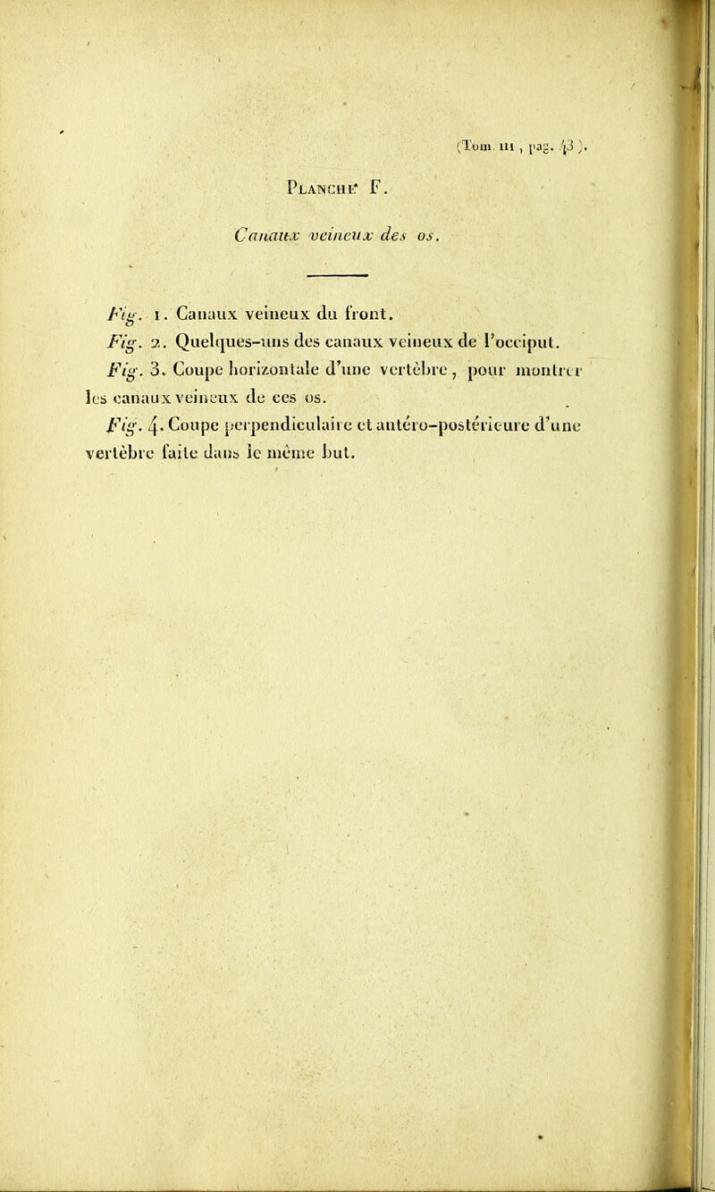 (Tu m. m , j>ag. /j3 ) Planché F. Canaux veineux des os. Fia. i. Canaux veineux du front. Fig. ?.. Quelques-uns des canaux veineux de l'occiput. Fig. 3. Coupe horizontale d'une vertèbre, pour montrer lus canaux veineux de ces os. Fig. 4- Coupe perpendiculaire et autéro-postérieure d'une vertèbre faile dans ic niême but.