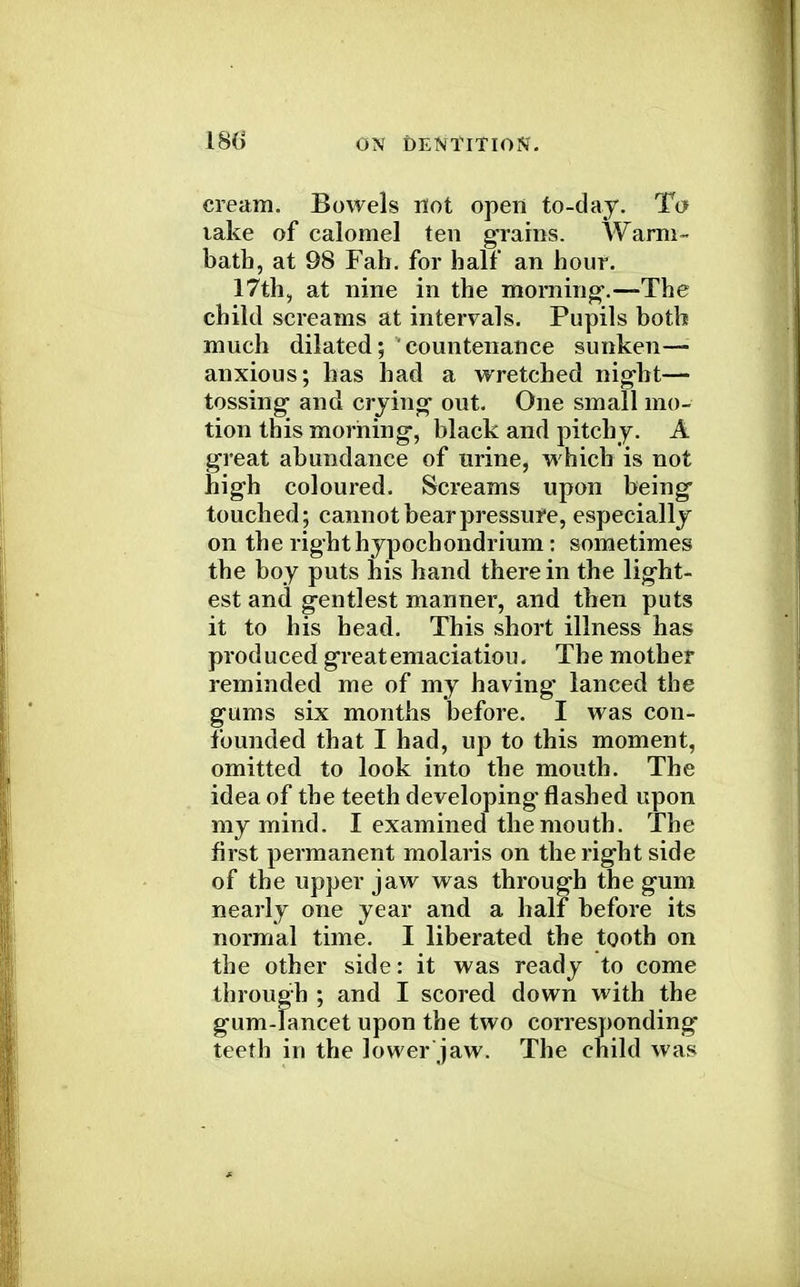 cream. Bowels not open to-day. To lake of calomel ten grains. Warm- bath, at 98 Fab. for half an hour. 17th, at nine in the morning'. —-The child screams at intervals. Pupils both much dilated; countenance sunken—• anxious; has had a wretched night— tossing and crying' out. One small mo- tion this morning-, black and pitchy. A great abundance of urine, which is not high coloured. Screams upon being touched; cannot bear pressure, especially on the right hypochondrium: sometimes the boy puts his hand therein the light- est and gentlest manner, and then puts it to his head. This short illness has produced greatemaciatiou. The mother reminded me of my having' lanced the gums six months before. I was con- founded that I had, up to this moment, omitted to look into the mouth. The idea of the teeth developing* flashed upon my mind. I examined the mouth. The first permanent molaris on the right side of the upper jaw was through the gum nearly one year and a half before its normal time. I liberated the tooth on the other side: it was ready to come through ; and I scored down with the gum-lancet upon the two corresponding teeth in the lower jaw. The child was