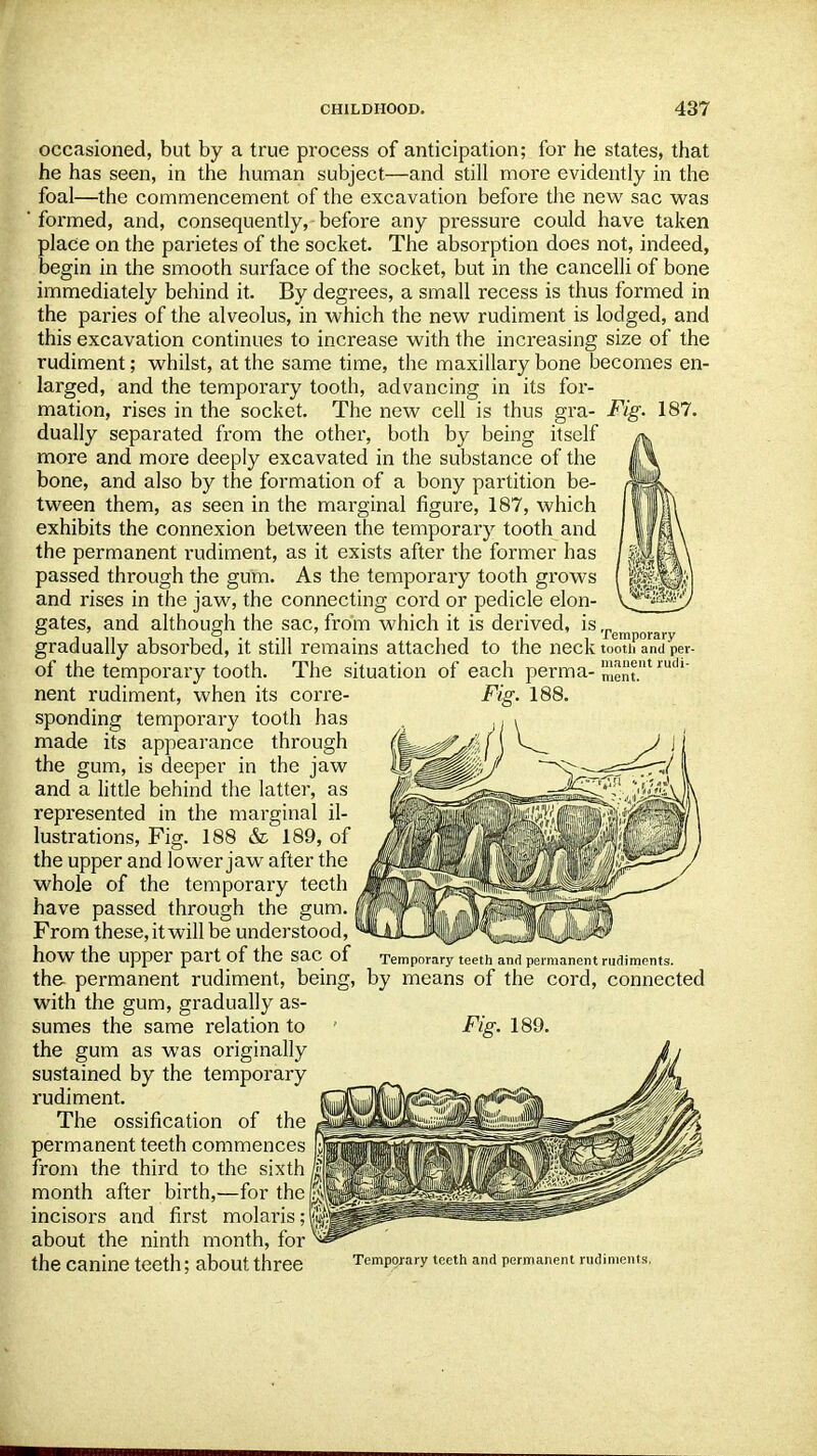 occasioned, but by a true process of anticipation; for he states, that he has seen, in the human subject—and still more evidently in the foal—the commencement of the excavation before the new sac was ' formed, and, consequently, before any pressure could have taken place on the parietes of the socket. The absorption does not, indeed, begin in the smooth surface of the socket, but in the cancelli of bone immediately behind it. By degrees, a small recess is thus formed in the paries of the alveolus, in which the new rudiment is lodged, and this excavation continues to increase with the increasing size of the rudiment; whilst, at the same time, the maxillary bone becomes en- larged, and the temporary tooth, advancing in its for- mation, rises in the socket. The new cell is thus gra- Fig. 187. dually separated from the other, both by being itself more and more deeply excavated in the substance of the bone, and also by the formation of a bony partition be- tween them, as seen in the marginal figure, 187, which exhibits the connexion between the temporary tooth and the permanent rudiment, as it exists after the former has passed through the gum. As the temporary tooth grows and rises in the jaw, the connecting cord or pedicle elon- gates, and although the sac, from which it is derived, i$ ,leu gradually absorbed, it still remains attached to the neck tooth and per- of the temporary tooth. The situation of each perma- Sent.1 ludl nent rudiment, when its corre- Fig. 188. sponding temporary tooth has made its appearance through the gum, is deeper in the jaw and a little behind the latter, as represented in the marginal il- lustrations, Fig. 188 & 189, of the upper and lower jaw after the whole of the temporary teeth have passed through the gum. From these, it will be understood, how the Upper part Of the Sac of Temporary teeth and permanent rudiments. the permanent rudiment, being, by means of the cord, connected with the gum, gradually as- sumes the same relation to p Fig. 189. the gum as was originally sustained by the temporary rudiment. The ossification of the permanent teeth commences from the third to the sixth month after birth,—for the incisors and first molaris; about the ninth month, for the Canine teeth; about three Temporary teeth and permanent rudi