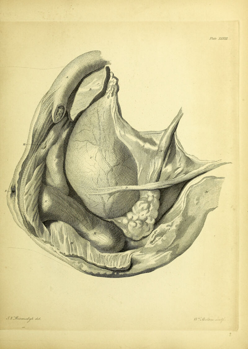 Plate xma.