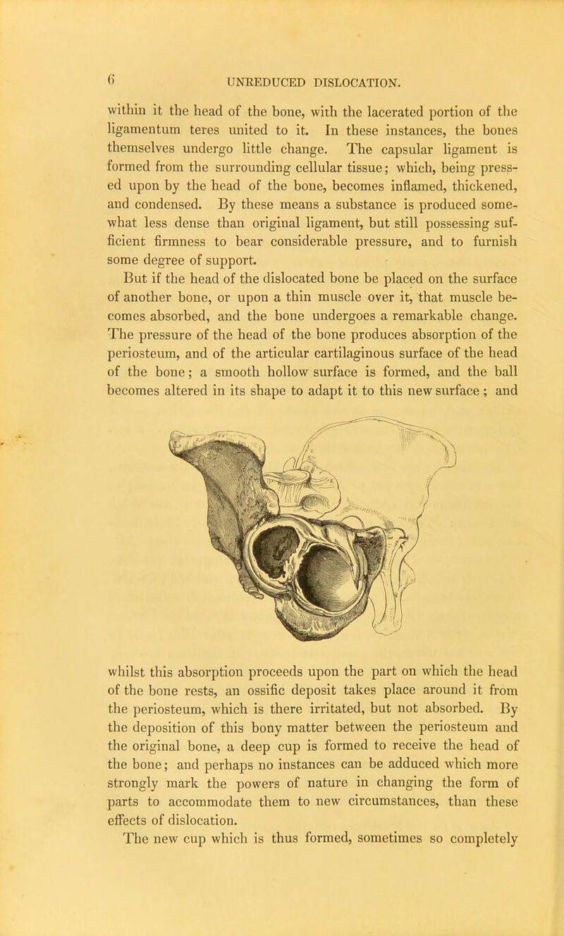 within it the head of the bone, with the lacerated portion of the ligamentum teres united to it. In these instances, the bones themselves undergo little change. The capsular ligament is formed from the surrounding cellular tissue; which, being press- ed upon by the head of the bone, becomes inflamed, thickened, and condensed. By these means a substance is produced some- what less dense than original ligament, but still possessing suf- ficient firmness to bear considerable pressure, and to furnish some degree of support. But if the head of the dislocated bone be placed on the surface of another bone, or upon a thin muscle over it, that muscle be- comes absorbed, and the bone undergoes a remarkable change. The pressure of the head of the bone produces absorption of the periosteum, and of the articular cartilaginous surface of the head of the bone; a smooth hollow surface is formed, and the ball becomes altered in its shape to adapt it to this new surface; and whilst this absorption proceeds upon the part on which the head of the bone rests, an ossific deposit takes place around it from the periosteum, which is there irritated, but not absorbed. By the deposition of this bony matter between the periosteum and the original bone, a deep cup is formed to receive the head of the bone; and perhaps no instances can be adduced which more strongly mark the powers of nature in changing the form of parts to accommodate them to new circumstances, than these effects of dislocation. The new cup which is thus formed, sometimes so completely