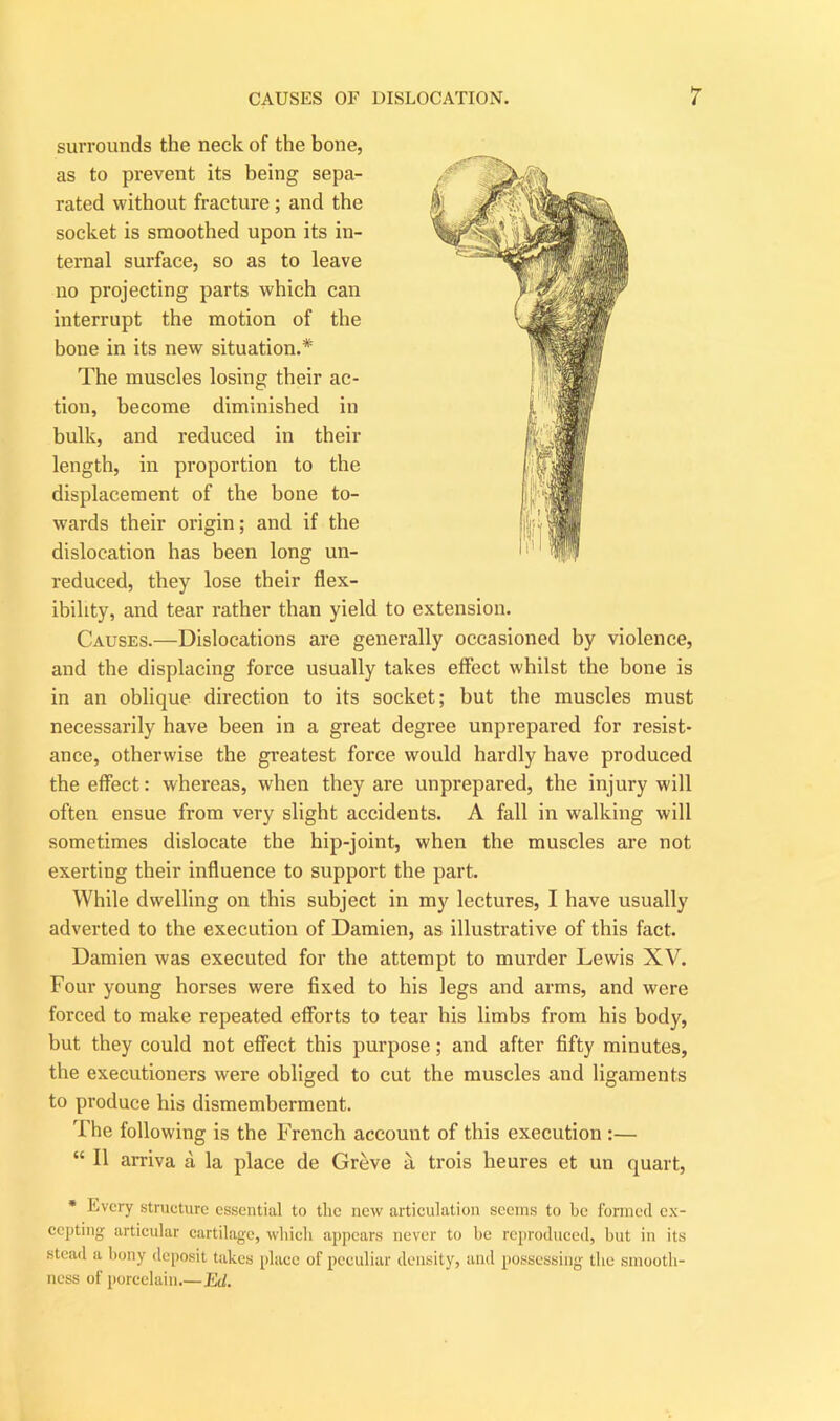 surrounds the neck of the bone, as to prevent its being sepa- rated without fracture ; and the socket is smoothed upon its in- ternal surface, so as to leave no projecting parts which can interrupt the motion of the bone in its new situation.* The muscles losing their ac- tion, become diminished in bulk, and reduced in their length, in proportion to the displacement of the bone to- wards their origin; and if the dislocation has been long un- reduced, they lose their flex- ibility, and tear rather than yield to extension. Causes.—Dislocations are generally occasioned by violence, and the displacing force usually takes effect whilst the bone is in an oblique direction to its socket; but the muscles must necessarily have been in a great degree unprepared for resist- ance, otherwise the greatest force would hardly have produced the effect: whereas, when they are unprepared, the injury will often ensue from very slight accidents. A fall in walking will sometimes dislocate the hip-joint, when the muscles are not exerting their influence to support the part. While dwelling on this subject in my lectures, I have usually adverted to the execution of Damien, as illustrative of this fact. Damien was executed for the attempt to murder Lewis XV. Four young horses were fixed to his legs and arms, and were forced to make repeated efforts to tear his limbs from his body, but they could not effect this purpose; and after fifty minutes, the executioners were obliged to cut the muscles and ligaments to produce his dismemberment. The following is the French account of this execution :— “ II arriva a la place de Greve a. trois heures et un quart, * Every structure essential to tlic new articulation seems to be formed ex- cepting articular cartilage, which appears never to he reproduced, hut in its stead a bony deposit takes place of peculiar density, and possessing the smooth- ness of porcelain.—Ed.