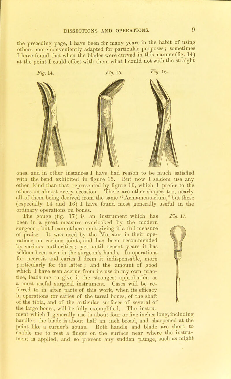 the preceding page, 1 have been for many years in the habit of using others more conveniently adapted for particular purposes ; sometimes I have found that when the blades were curved in this manner (fig. 14) at the point I could effect with them what I could not with the straight ones, and in other instances I have had reason to be mirch satisfied with the bend exhibited in figure 15. But now I seldom use any other kind than that represented by figure 16, which I prefer to the others on almost every occasion. There are other shapes, too, nearly all of them being derived from the same “ Armamentarium,” but these (especially 14 and 16) I have found most generally useful in the ordinary operations on bones. The gouge (fig. 17) is an instrument which has Fig. 17. been in a great measure overlooked by the modern surgeon ; but I cannot here omit giving it a full measure of praise. It was used by the Moreaus in their ope- rations on carious joints, and has been recommended by various authorities; yet until recent years it has seldom been seen in the surgeon’s hands. In operations for necrosis and caries I deem it indispensable, more particularly for the latter ; and the amount of good which I have seen accrue from its use in my own prac- tice, leads me to give it the strongest approbation as a most useful surgical instrument. Cases will be re- ferred to in after parts of this work, when its efficacy in operations for caries of the tarsal bones, of the shaft of the tibia, and of the articular surfaces of several of the large bones, will bo fully exemplified. The instru- ment which I generally use is about four or five inches long, including handle; the blade is about half an inch broad, and sharpened at the point like a turner’s gouge. Both handle and blade are short, to enable me to rest a finger on the surface near where the instru- ment is applied, and so prevent any sudden plunge, such as might