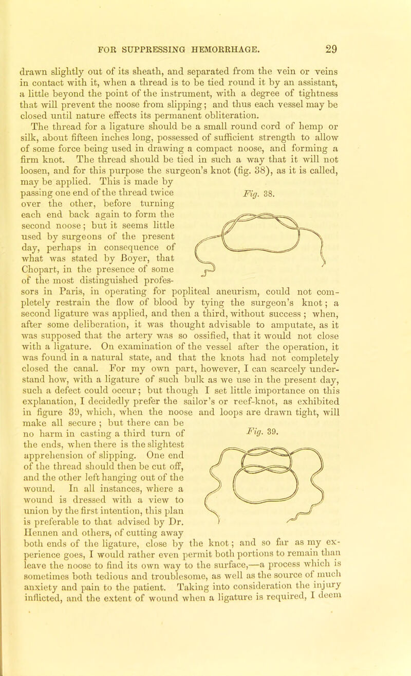 drawn slightly out of its sheath, and separated from the vein or veins in contact with it, when a thread is to be tied round it by an assistant, a little beyond the point of the instrument, with a degree of tightness that wiU prevent the noose from slipping; and thus each vessel may be closed until nature elfects its permanent obliteration. The thread for a ligature should be a small round cord of hemp or silk, about fifteen inches long, possessed of sufficient strength to allow of some force being used in drawing a compact noose, and forming a firm knot. The thread should be tied in such a way that it will not loosen, and for this purpose the surgeon’s knot (fig. 38), as it is called, may be applied. This is made by each end back again to form the second noose; but it seems little used by surgeons of the present day, perhaps in consequence of what was stated by Boyer, that Chopart, in the presence of some of the most distinguished profes- sors in Paris, in operating for popliteal aneurism, could not com- pletely restrain the flow of blood by tying the surgeon’s knot; a second ligature was applied, and then a third, without success ; when, after some deliberation, it was thought advisable to amputate, as it was supposed that the artery was so ossified, that it would not close with a ligature. On examination of the vessel after the operation, it was found in a natural state, and that the knots had not completely closed the canal. For my own part, however, I can scarcely under- stand how, with a ligature of such bulk as we use in the present day, such a defect could occur; but though I set little importance on this explanation, I decidedly prefer the sailor’s or reef-knot, as exhibited in figure 39, which, when the noose and loops are drawn tight, will make all secure ; but there can be the ends, when there is the slightest apprehension of slipping. One end of the thread should then be cut off, and the other left hanging out of the wound. In all instances, where a wound is dressed with a view to union by the first intention, this plan is preferable to that advised by Dr. Ilennen and others, of cutting away both ends of the ligature, close by the knot; and so far as my ex- perience goes, I would rather even permit both portions to remain than leave the noose to find its own way to the surface,—a process which is sometimes both tedious and troublesome, as well as the source of inuch anxiety and pain to the patient. Taking into consideration the injury inflicted, and the extent of wound when a ligature is required, I deem