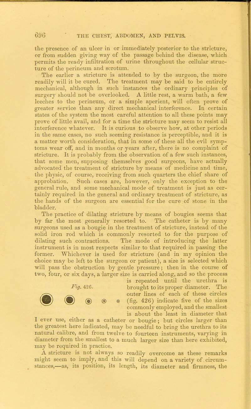 the presence of an ulcer in or immediately posterior to the stricture, or from sudden giving way of the passage behind the disease, wdiich permits the ready infiltration of urine throughout the cellular struc- ture of the perineum and scrotum. The earlier a stricture is attended to by the surgeon, the more readily will it be cured. The treatment may be said to be entirely mechanical, although in such instances the ordinary principles of surgery should not be overlooked. A little rest, a warm bath, a few leeches to the perineum, or a simple aperient, will often prove of greater service than any direct mechanical interference. In certain states of the system the most careful attention to all these points may prove of little avail, and for a time the stricture may seem to resist all interference whatever. It is curious to observe how, at other periods in the same cases, no such seeming resistance is perceptible, and it is a matter worth consideration, that in some of these all the evil symp- toms wear off, and in months or years after, there is no complaint of stricture. It is probably from the observation of a few such instances, that some men, supposing themselves good surgeons, have actually advocated the treatment of stricture by means of medicine and time, the physic, of course, receiving from such quarters the chief share of approbation. Such cases are, however, only the exception to the general rule, and some mechanical mode of treatment is just as cer- tainly required in the general and ordinary treatment of stricture, as the hands of the surgeon are essential for the cure of stone in the bladder. The practice of dilating stricture by means of bougies seems that by far the most generally resorted to. The catheter is by many surgeons used as a bougie in the treatment of stricture, instead of the solid iron rod which is commonly resorted to for the purpose of dilating such contractions. The mode of introducing the latter instrument is in most respects similar to that required in pas,sing the former. Whichever is used for stricture (and in my opinion the choice may be left to the surgeon or patient), a size is selected -which ■w'ill pass the obstruction by gentle pressure; then in the course of two, four, or six days, a larger size is carried along, and so the process is repeated until the urethra is Fig.4:2Q. brought to its proper diameter. The outer lines of each of these circles vjy (i) ® ® (fig. 426) indicate five of the sizes commonly emjffoyed, and the smallest is about the least in diameter that I ever use, either as a catheter or bougie ; but circles larger than the greatest here indicated, may be needful to bring the urethra to its natural calibre, and from twelve to fourteen instruments, varying in diameter from the smallest to a much larger size than here exhibited, may be required in practice. A stricture is not always so readily overcome as these remarks might seem to imidy, and this will depend on a variety of circum- stances,—as, its position, its length, its diameter and firmness, the