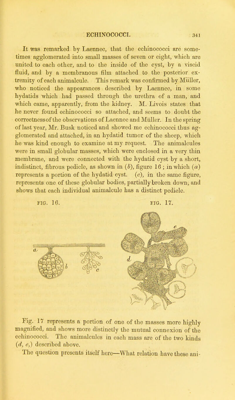 It was remarked by Laennec, that the echinococci are some- times agglomerated into small masses of seven or eight, which are united to each other, and to the inside of the cyst, by a viscid fluid, and by a membranous film attached to the posterior ex- tremity of each animalcule. This remark was confirmed by Miiller, who noticed the appearances described by Laennec, in some hydatids which had passed through the urethra of a man, and which came, apparently, from the kidney. M. Livois states that he never found echinococci so attached, and seems to doubt the correctness of the observations of Laennec and Muller. In the spring of last year, Mr. Busk noticed and showed me echinococci thus ag- glomerated and attached, in an hydatid tumor of the sheep, which he wras kind enough to examine at my request. The animalcules were in small globular masses, which were enclosed in a very thin membrane, and were connected with the hydatid cyst by a short, indistinct, fibrous pedicle, as shown in (b), figure 16 ; in which (a) represents a portion of the hydatid cyst. (c), in the same figure, represents one of these globular bodies, partially broken down, and shows that each individual animalcule has a distinct pedicle. FIG. 10. FIG. 17. Fig. 17 represents a portion of one of the masses more highly magnified, and shows more distinctly the mutual connexion of the echinococci. The animalcules in each mass arc of the two kinds (d, e,) described above. The question presents itself here—What relation have these ani-