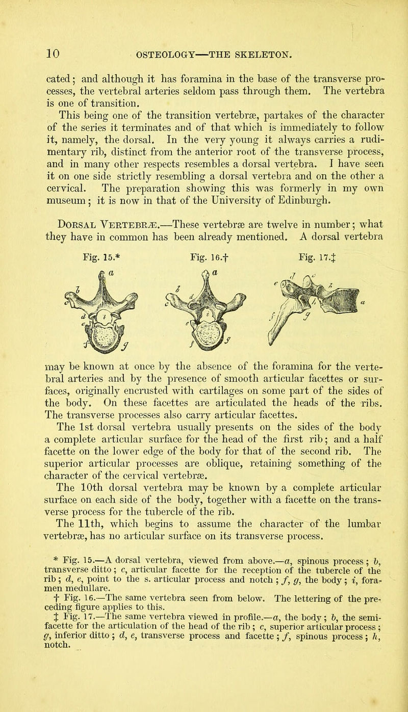 cated; and although it has foramina in the base of the transverse pro- cesses, the vertebral arteries seldom pass through them. The vertebra is one of transition. This being one of the transition vertebrae, partakes of the character of the series it terminates and of that which is immediately to follow it, namely, the dorsal. In the very young it always carries a rudi- mentary rib, distinct from the anterior root of the transverse process, and in many other respects resembles a dorsal vertebra. I have seen it on one side strictly resembling a dorsal vertebra and on the other a cervical. The preparation showing this was formerly in my own museum; it is now in that of the University of Edinburgh. Dorsal Vertebrae.—These vertebrse are twelve in number; what they have in common has been already mentioned. A dorsal vertebra may be known at once by the absence of the foramina for the verte- bral arteries and by the presence of smooth articular facettes or sur- faces, originally encrusted with cartilages on some part of the sides of the body. On these facettes are articulated the heads of the ribs. The transverse processes also carry articular facettes. The 1st dorsal vertebra usually presents on the sides of the body a complete articular surface for the head of the first rib; and a half facette on the lower edge of the body for that of the second rib. The superior articular processes are oblique, retaining something of the character of the cervical vertebrae. The 10th dorsal vertebra may be known by a complete articular surface on each side of the body, together with a facette on the trans- verse process for the tubercle of the rib. The 11th, which begins to assume the character of the lumbar vertebrae, has no articular surface on its transverse process. * Fig. 15.—A dorsal vertebra, viewed from above.—a, spinous process; b, transverse ditto; c, articular facette for the reception of the tubercle of the rib; d, e, point to the s. articular process and notch ; /, <j, the body; i, fora- men medullare. j- Fig. 16.—The same vertebra seen from below. The lettering of the pre- ceding figure applies to this. J Fig. 17.—The same vertebra viewed in profile.—a, the body; b, the semi- facette for the articulation of the head of the rib; c, superior articular process ; g, inferior ditto ; d, e, transverse process and facette ; /, spinous process ; h, notch.