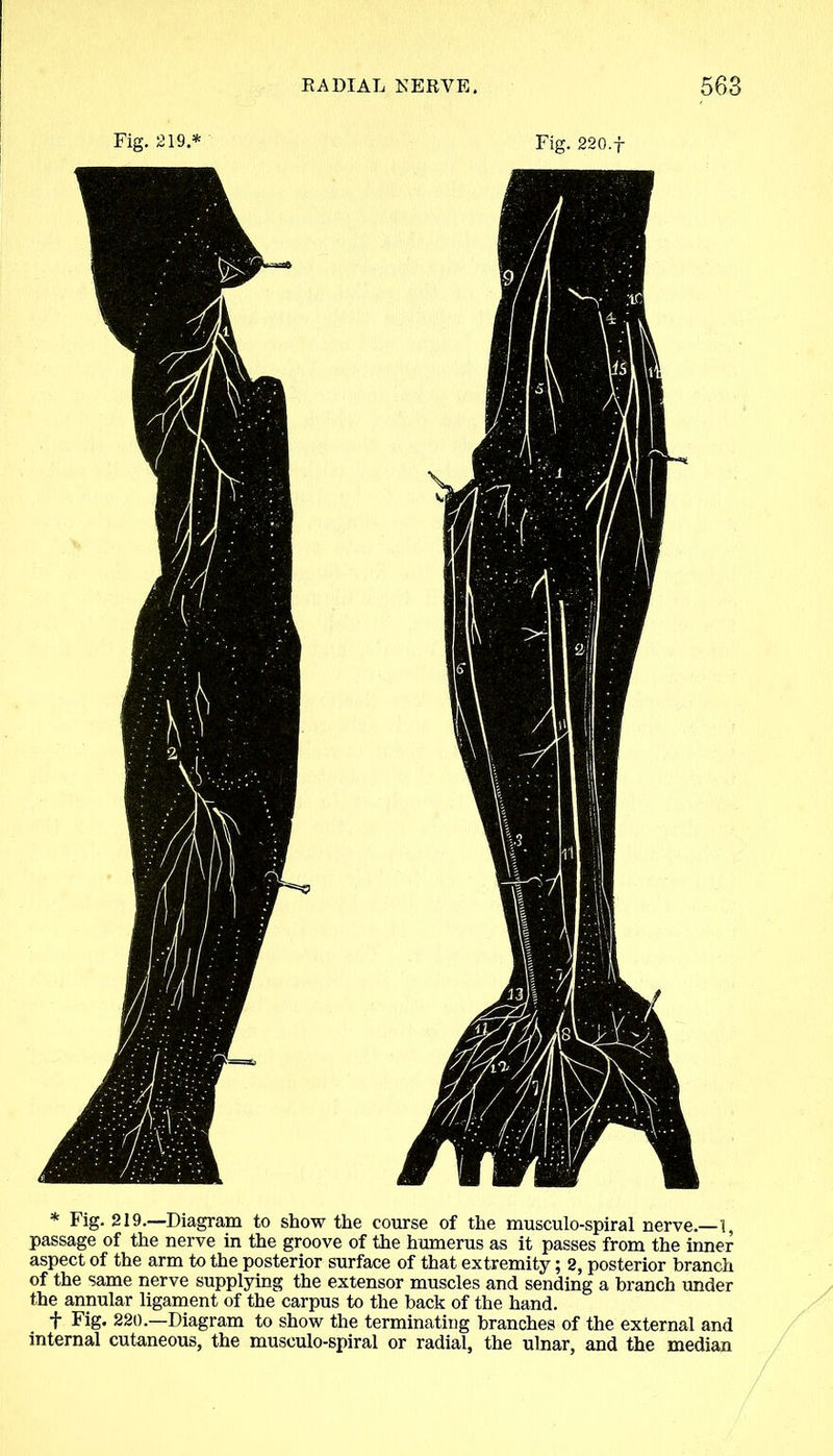 * Fig- 219.—Diagram to show the course of the musculo-spiral nerve.—1, passage of the nerve in the groove of the humerus as it passes from the inner aspect of the arm to the posterior surface of that extremity; 2, posterior branch of the same nerve supplying the extensor muscles and sending a branch under the annular ligament of the carpus to the back of the hand. f Fig. 220.—Diagram to show the terminating branches of the external and internal cutaneous, the musculo-spiral or radial, the ulnar, and the median