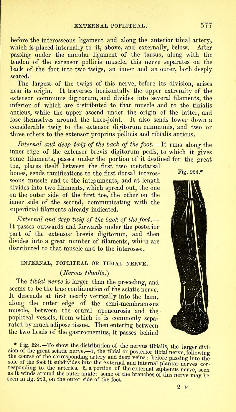 before the interosseous ligament and along the anterior tibial artery, which is placed internally to it, above, and externally, below. After passing under the annular ligament of the tarsus, along with the tendon of the extensor pollicis muscle, this nerve separates on the back of the foot into two twigs, an inner and an outer, both deeply seated. The largest of the twigs of this nerve, before its division, arises near its origin. It traverses horizontally the upper extremity of the extensor communis digitorum, and divides into several filaments, the inferior of which are distributed to that muscle and to the tibialis anticus, while the upper ascend under the origin of the latter, and lose themselves around the knee-joint. It also sends lower down a considerable twig to the extensor digitorum cummunis, and two or three others to the extensor proprius pollicis and tibialis anticus. Internal and deep twig of the back of the foot.—It runs along the inner edge of the extensor brevis digitorum pedis, to which it gives some filaments, passes under the portion of it destined for the great toe, places itself between the first two metatarsal bones, sends ramifications to the first dorsal interos- seous muscle and to the integuments, and at length divides into two filaments, which spread out, the one on the outer side of the first toe, the other on the inner side of the second, communicating with the superficial filaments already indicated. External and deep twig of the back of the foot.— It passes outwards and forwards under the posterior part of the extensor brevis digitorum, and then divides into a great number of filaments, which are distributed to that muscle and to the interossei. INTERNAL, POPLITEAL OR TIBIAL NERVE. (Nervus tibialis.) The tibial nerve is larger than the preceding, and seems to be the true continuation of the sciatic nerve. It descends at first nearly vertically into the ham, along the outer edge of the semi-membranosus muscle, between the crural aponeurosis and the popliteal vessels, from which it is commonly sepa- rated by much adipose tissue. Then entering between the two heads of the gastrocnemius, it passes behind * Fig. 224.—To show the distribution of the nervus tibialis, the larger divi- sion of the great sciatic nerve.—1, the tibial or posterior tibial nerve, following the course of the corresponding artery and deep veins : before passing into the sole of the foot it subdivides into the external and internal plantar nerves cor- responding to the arteries. 2, a portion of the external saphenus nerve seen as it winds around the outer ankle: some of the branches of this nerve m’av be seen in fig. 223, on the outer side of the foot. J 2 P