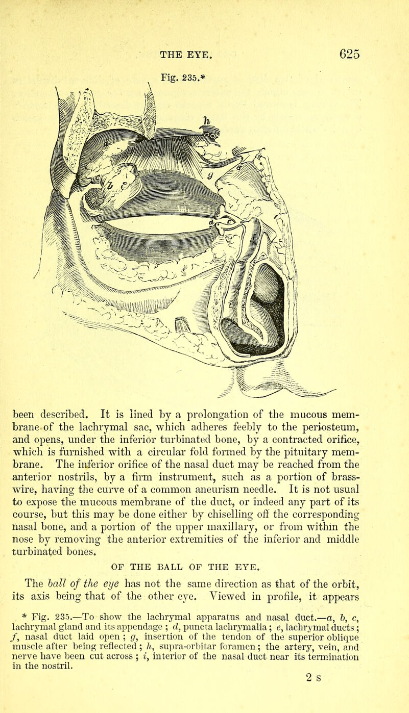 been described. It is lined by a prolongation of the mucous mem- brane of the lachrymal sac, which adheres feebly to the periosteum, and opens, under the inferior turbinated bone, by a contracted orifice, which is furnished with a circular fold formed by the pituitary mem- brane. The inferior orifice of the nasal duct may be reached from the anterior nostrils, by a firm instrument, such as a portion of brass- wire, having the curve of a common aneurism needle. It is not usual to expose the mucous membrane of the duct, or indeed any part of its course, but this may be done either by chiselling off the corresponding nasal bone, and a portion of the upper maxillary, or from within the nose by removing the anterior extremities of the inferior and middle turbinated bones. OF THE BALL OF THE EYE. The ball of the eye has not the same direction as that of the orbit, its axis being that of the other eye. Viewed in profile, it appears * Fig. 235.—To show the lachrymal apparatus and nasal duct.—a, b, c, lachrymal gland and its appendage ; d, puncta laclirymalia; e, lachrymal ducts; /, nasal duct laid open ; g, insertion of the tendon of the superior oblique muscle after being reflected ; h, supra-orbitar foramen; the artery, vein, and nerve have been cut across ; i, interior of the nasal duct near its termination in the nostril. 2 s