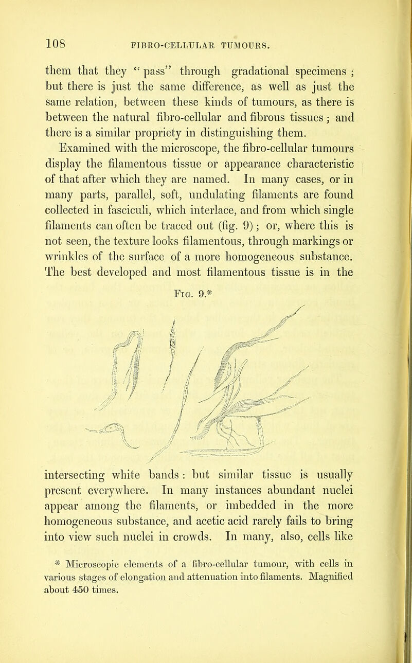 them that they “ pass” through gradational specimens ; but there is just the same difference, as well as just the same relation, between these kinds of tumours, as there is betw'een the natural fibro-cellular and fibrous tissues ; and there is a similar propriety in distinguishing them. Examined with the microscope, the fibro-cellular tumours display the filamentous tissue or appearance characteristic of that after which they are named. In many cases, or in many parts, parallel, soft, undulating filaments are found collected in fasciculi, which interlace, and from which single filaments can often be traced out (fig. 9); or, where this is not seen, the texture looks filamentous, through markings or wrinkles of the surface of a more homogeneous substance. The best developed and most filamentous tissue is in the Tio. 9.* intersecting white bands : but similar tissue is usually present everywhere. In many instances abundant nuclei appear among the filaments, or imbedded in the more homogeneous substance, and acetic acid rarely fails to bring into view such nuclei in crowds. In many, also, cells like * Microscopic elements of a fibro-cellular tumour, with cells in various stages of elongation and attenuation into filaments. Magnified about 450 times.