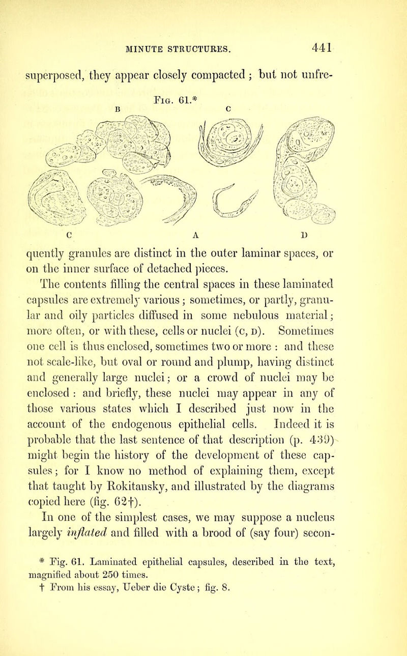 superposed, they appear closely compacted ; but not uiifre- Fig. 61.* B c quently granules are distinct in the outer laminar spaces, or on the inner surface of detached jiieces. The contents filling the central spaces in these laminated capsules are extremely various ; sometimes, or partly, granu- lar and oily particles diffused in some nebulous material; more often, or with these, cells or nuclei (c, n). Sometimes one cell is thus enclosed, sometimes two or more : and these not scale-like, but oval or round and plump, having distinct and generally large nuclei; or a crowd of nuclei may be enclosed : and briefly, these nuclei may appear in any of those various states which I described just now in the account of the endogenous epithelial cells. Indeed it is probable that the last sentence of that description (p. 439) might begin the history of the development of these cap- sules ; for I know no method of explaining them, except that taught by Rokitansky, and illustrated by the diagrams copied here (fig. 62f). In one of the simplest cases, we may suppose a nucleus largely injiated and filled with a brood of (say four) secon- * Fig. 61, Laminated epithelial capsules, described in the text, magnified about 250 times. t From his essay, Ueber die Cyste ; fig. 8.