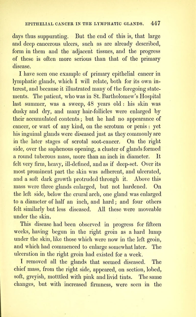 days thus suppurating. But the end of this is, that large and deep cancerous ulcers, such as are already described, form in them and the adjacent tissues, and the progress of these is often more serious than that of the primary disease. I have seen one example of primary epithelial cancer in lymphatic glands, which I will relate, botli for its own in- terest, and because it illustrated many of the foregoing state- ments. The patient, who was in St. Bartholomew’s Hospital last summer, was a sweep, 48 years old : his skin was dusky and dry, and many hair-follicles were enlarged by their accumulated contents; but he had no appearance of cancer, or wart of any kind, on the scrotum or penis : yet his inguinal glands were diseased just as they commonly are in the later stages of scrotal soot-cancer. On the right side, over the saphenous opening, a cluster of glands formed a round tuberous mass, more than an inch in diameter. It felt very firm, heavy, ill-defined, and as if deep-set. Over its most prominent part the skin was adherent, and ulcerated, and a soft dark growth protruded through it. Above this mass were three glands enlarged, but not hardened. On the left side, below the crural arch, one gland was enlarged to a diameter of half an inch, and hard; and four others felt similarly but less diseased. All these were moveable under the skin. This disease had been observed in progress for fifteen weeks, having begun in the right groin as a hard lump under the skin, like those which were now in the left groin, and which had commenced to enlarge somewhat later. The ulceration in the right groin had existed for a week. I removed all the glands that seemed diseased. The chief mass, from the right side, appeared, on section, lobed, soft, greyish, motttled with pink and livid tints. The same changes, but with increased firmness, were seen in the