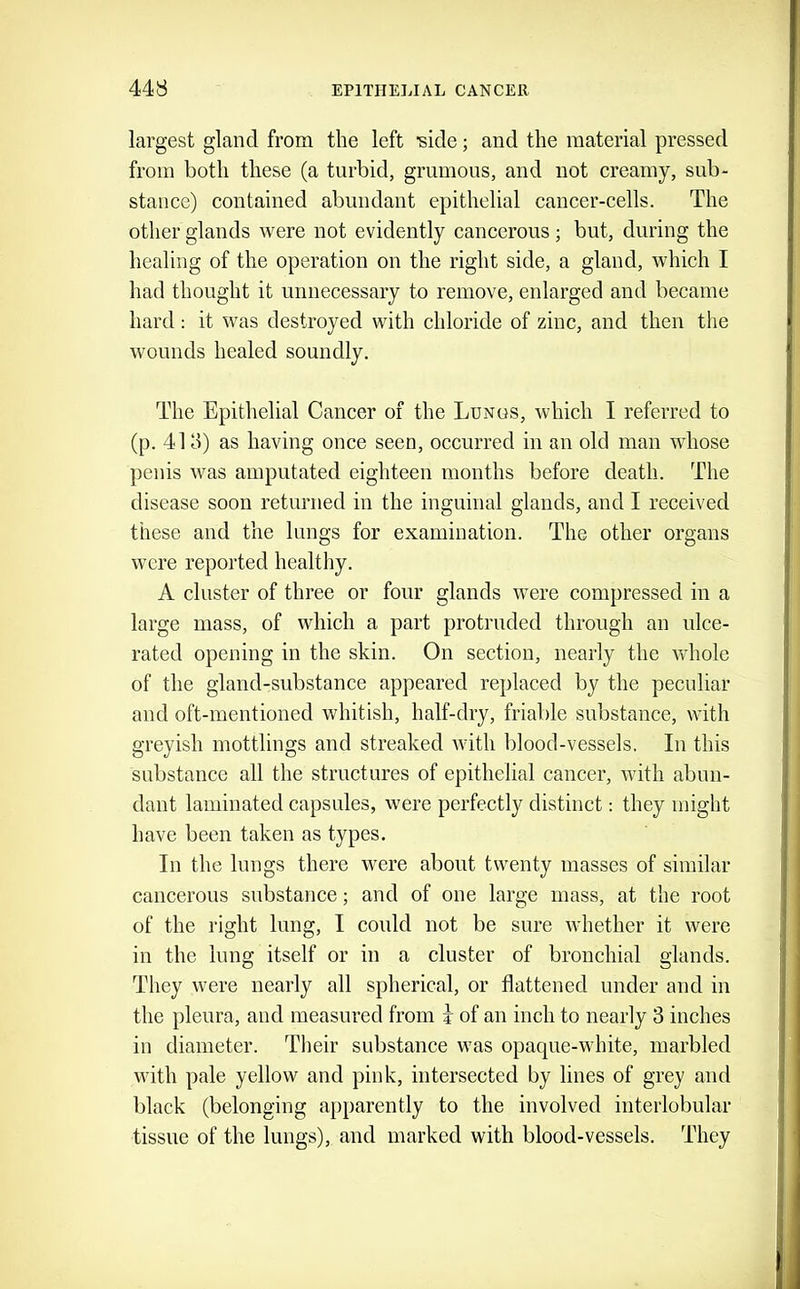 largest gland from the left side; and the material pressed from both these (a turbid, grumons, and not creamy, sub- stance) contained abundant epithelial cancer-cells. The other glands were not evidently cancerous; but, during the healing of the operation on the right side, a gland, which I had thought it unnecessary to remove, enlarged and became hard: it was destroyed with chloride of zinc, and then the wounds healed soundly. The Epithelial Cancer of the Lungs, which I referred to (p. 4Id) as having once seen, occurred in an old man whose penis was amputated eighteen months before death. The disease soon returned in the inguinal glands, and I received these and the lungs for examination. The other organs were reported healthy. A cluster of three or four glands were compressed in a large mass, of which a part protruded through an ulce- rated opening in the skin. On section, nearly the whole of the gland-substance appeared replaced by the peculiar and oft-mentioned whitish, half-dry, friable substance, with greyish mottlings and streaked with blood-vessels. In this substance all the structures of epithelial cancer, with abun- dant laminated capsules, were perfectly distinct; they might have been taken as types. In the lungs there were about twenty masses of similar cancerous substance; and of one large mass, at the root of the right lung, I could not be sure whether it were in the lung itself or in a cluster of bronchial glands. They were nearly all spherical, or flattened under and in the pleura, and measured from I of an inch to nearly 3 inches in diameter. Their substance was opaque-white, marbled with pale yellow and pink, intersected by lines of grey and black (belonging apparently to the involved interlobular tissue of the lungs), and marked with blood-vessels. They