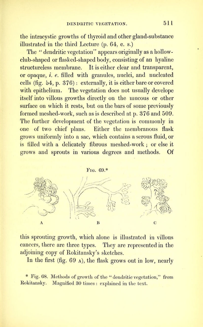 the intracystic growths of thyroid and other gland-substance illustrated in the third Lecture (p. 64.. e. s.) The “ dendritic vegetation” appears originally as a hollow- club-shaped or flasked-shaped body, consisting of an hyaline structureless membrane. It is either clear and transparent, or opaque, i. e. filled with granules, nuclei, and nucleated cells (fig. 54, p. 376) -. externally, it is either bare or covered with epithelium. The vegetation does not usually develope itself into villous growths directly on the mucous or other surface on which it rests, but on the bars of some previously formed meshed-work, such as is described at p. 376 and 509. The further development of the vegetation is commonly in one of two chief plans. Either the membranous flask grows uniformly into a sac, which contains a serous fluid, or is filled with a delicately fibrous meshed-work; or else it grows and sprouts in various degrees and methods. Of this sprouting growth, which alone is illustrated in villous cancers, there are three types. They are represented in the adjoining copy of Rokitansky’s sketches. In the first (fig. 69 a), the flask grows out in low, nearly * Fig. G8. Methods of growth of the “ dendritic vegetation,” from Kokitansky. Magnified 30 times : explained in tlie text.