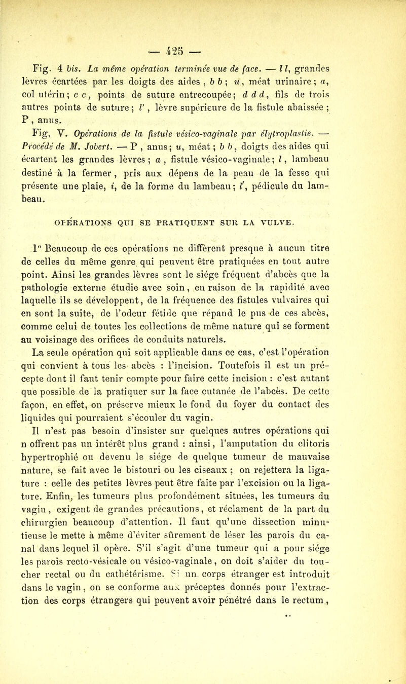 Fig. 4 bis. La même opération terminée me de face. — II, grandes lèvres écartées par les doigts des aides ,6 6; u, méat urinaire; a, col utérin; c c, points de suture entrecoupée; d dd, fils de trois autres points de suture; V , lèvre supérieure de la fistule abaissée ; P , anus. Fig, Y. Opérations de la fistule vésico-vaginale par élylroplastie. — Procédé de M. Jobert. — P , anus; u, méat ; 6 6, doigts des aides qui écartent les grandes lèvres; a, fistule vésico-vaginale ; l, lambeau destiné à la fermer , pris aux dépens de la peau de la fesse qui présente une plaie, i, de la forme du lambeau; l', pédicule du lam- beau. OPERATIONS QUI SE PRATIQUENT SUR LA VULVE. 1 Beaucoup de ces opérations ne diffèrent presque à aucun titre de celles du même genre qui peuvent être pratiquées en tout autre point. Ainsi les grandes lèvres sont le siège fréquent d’abcès que la pathologie externe étudie avec soin, en raison de la rapidité avec laquelle ils se développent, de la fréquence des fistules vulvaires qui en sont la suite, de l’odeur fétide que répand le pus de ces abcès, comme celui de toutes les collections de même nature qui se forment au voisinage des orifices de conduits naturels. La seule opération qui soit applicable dans ce cas, c’est l’opération qui convient à tous les abcès : l’incision. Toutefois il est un pré- cepte dont il faut tenir compte pour faire cette incision : c’est autant que possible de la pratiquer sur la face cutanée de l’abcès. De cette façon, en effet, on préserve mieux le fond du foyer du contact des liquides qui pourraient s’écouler du vagin. Il n’est pas besoin d’insister sur quelques autres opérations qui n offrent pas un intérêt plus grand : ainsi, l’amputation du clitoris hypertrophié ou devenu le siège de quelque tumeur de mauvaise nature, se fait avec le bistouri ou les ciseaux ; on rejettera la liga- ture : celle des petites lèvres peut être faite par l’excision ou la liga- ture. Enfin, les tumeurs plus profondément situées, les tumeurs du vagin, exigent de grandes précautions, et réclament de la part du chirurgien beaucoup d’attention. Il faut qu’une dissection minu- tieuse le mette à même d’éviter sûrement de léser les parois du ca- nal dans lequel il opère. S’il s’agit d’une tumeur qui a pour siège les parois recto-vésicale ou vésico-vaginale, on doit s’aider du tou- cher rectal ou du cathétérisme. Si un corps étranger est introduit dans le vagin, on se conforme aux préceptes donnés pour l’extrac- tion des corps étrangers qui peuvent avoir pénétré dans le rectum ,