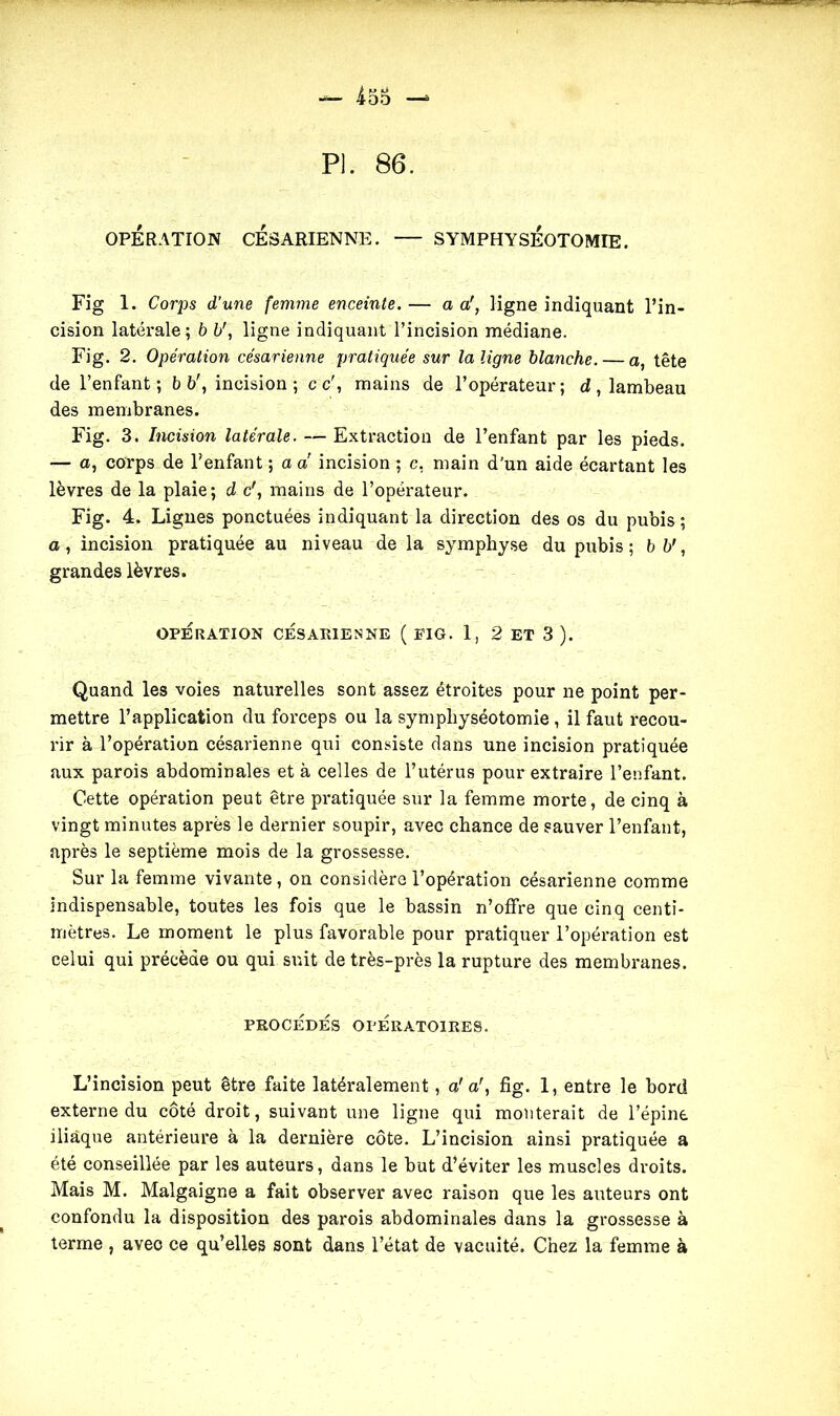 PI. 86. OPÉRATION CÉSARIENNE. — SYMPHYSÉOTOMIE. Fig 1. Corps d’une femme enceinte. — a a', ligne indiquant l’in- cision latérale; b b', ligne indiquant l’incision médiane. Fig. 2. Opération césarienne pratiquée sur la ligne blanche. — a, tête de l’enfant; b b', incision; c c\ mains de l’opérateur; d, lambeau des membranes. Fig. 3. Incision latérale. — Extraction de l’enfant par les pieds. — a, corps de l’enfant ; a a incision ; c, main d’un aide écartant les lèvres de la plaie; d c', mains de l’opérateur. Fig. 4. Lignes ponctuées indiquant la direction des os du pubis ; a, incision pratiquée au niveau de la symphyse du pubis; b b1, grandes lèvres. OPERATION CÉSARIENNE ( FIG. 1, 2 ET 3 ). Quand les voies naturelles sont assez étroites pour ne point per- mettre l’application du forceps ou la symphyséotomie , il faut recou- rir à l’opération césarienne qui consiste dans une incision pratiquée aux parois abdominales et à celles de l’utérus pour extraire l’enfant. Cette opération peut être pratiquée sur la femme morte, de cinq à vingt minutes après le dernier soupir, avec chance de sauver l’enfant, après le septième mois de la grossesse. Sur la femme vivante, on considère l’opération césarienne comme indispensable, toutes les fois que le bassin n’offre que cinq centi- mètres. Le moment le plus favorable pour pratiquer l’opération est celui qui précède ou qui suit de très-près la rupture des membranes. PROCÉDÉS OPÉRATOIRES. L’incision peut être faite latéralement, a’ a\ fig. 1, entre le bord externe du côté droit, suivant une ligne qui monterait de l’épine iliaque antérieure à la dernière côte. L’incision ainsi pratiquée a été conseillée par les auteurs, dans le but d’éviter les muscles droits. Mais M. Malgaigne a fait observer avec raison que les auteurs ont confondu la disposition des parois abdominales dans la grossesse à terme , avec ce qu’elles sont dans l’état de vacuité. Chez la femme à