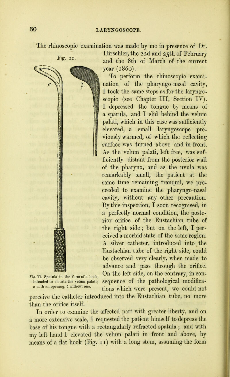 Fig. ii. The rhinoscopic examination was made by me in presence of Dr. Hirschler, the 2 2d and 25th of February and the 8th of March of the current year (i860). To perform the rhinoscopic exami- nation of the pharyngo-nasal cavity, I took the same steps as for the laryngo- scopic (see Chapter III, Section IY). I depressed the tongue by means of a spatula, and I slid behind the velum palati, which in this case was sufficiently elevated, a small laryngoscope pre- viously warmed, of which the reflecting surface was turned above and in front. As the velum palati, left free, was suf- ficiently distant from the posterior wall of the pharynx, and as the uvula was remarkably small, the patient at the same time remaining tranquil, we pro- ceeded to examine the pharyngo-nasal cavity, without any other precaution. By this inspection, I soon recognised, in a perfectly normal condition, the poste- rior orifice of the Eustachian tube of the right side; but on the left, I per- ceived a morbid state of the same region. A silver catheter, introduced into the Eustachian tube of the right side, could be observed very clearly, when made to advance and pass through the orifice. On the left side, on the contrary, in con- sequence of the pathological modifica- tions which were present, we could not perceive the catheter introduced into the Eustachian tube, no more than the orifice itself. I11 order to examine the affected part with greater liberty, and on a more extensive scale, I requested the patient himself to depress the base of his tongue with a rectangularly refracted spatula ; and with my left hand I elevated the velum palati in front and above, by means of a flat hook (Eig. 11) with a long stem, assuming the form Fig. 11. Spatula in the form of a hook, intended to elevate the velum palati; a with an opening, b without one.