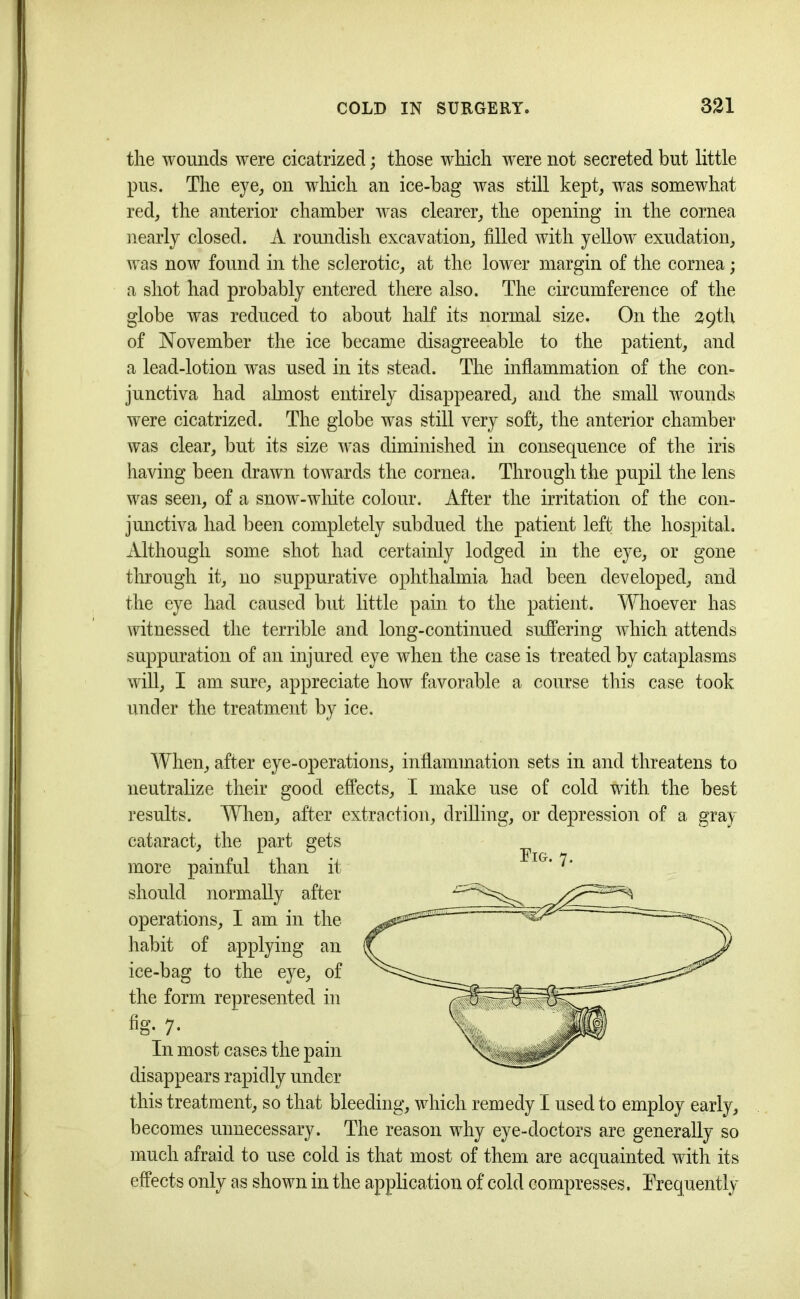the wounds were cicatrized; those which were not secreted but little pus. The eye, on which an ice-bag was still kept, was somewhat red, the anterior chamber was clearer, the opening in the cornea nearly closed. A roundish excavation, filled with yellow exudation, was now found in the sclerotic, at the lower margin of the cornea; a shot had probably entered there also. The circumference of the globe was reduced to about half its normal size. On the 39th of November the ice became disagreeable to the patient, and a lead-lotion was used in its stead. The inflammation of the con- junctiva had almost entirely disappeared, and the small wounds were cicatrized. The globe wTas still very soft, the anterior chamber was clear, but its size was diminished in consequence of the iris having been drawn towards the cornea. Through the pupil the lens was seen, of a snow-white colour. After the irritation of the con- junctiva had been completely subdued the patient left the hospital. Although some shot had certainly lodged in the eye, or gone through it, no suppurative ophthalmia had been developed, and the eye had caused but little pain to the patient. Whoever has witnessed the terrible and long-continued suffering which attends suppuration of an injured eye when the case is treated by cataplasms will, I am sure, appreciate how favorable a course this case took under the treatment by ice. When, after eye-operations, inflammation sets in and threatens to neutralize their good effects, I make use of cold with the best results. When, after extraction, drilling, or depression of a gray cataract, the part gets more painful than it should normally after operations, I am in the habit of applying an ice-bag to the eye, of the form represented in %. 7. In most cases the pain disappears rapidly under this treatment, so that bleeding, which remedy I used to employ early, becomes unnecessary. The reason why eye-doctors are generally so much afraid to use cold is that most of them are acquainted with its effects only as shown in the application of cold compresses. Frequently