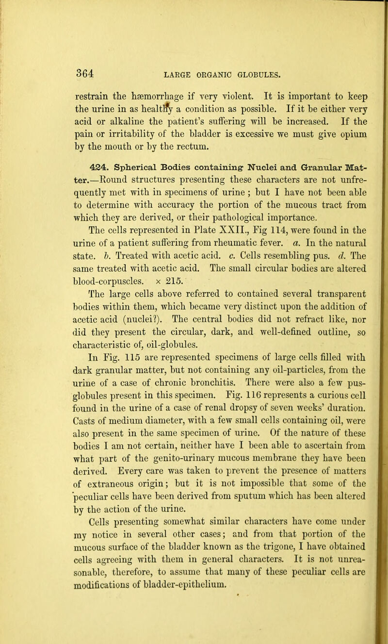 restrain the haemorrhage if very violent. It is important to keep the urine in as healtlfy a condition as possible. If it be either very acid or alkaline the patient’s suffering will be increased. If the pain or irritability of the bladder is excessive we must give opium by the mouth or by the rectum. 424. Spherical Bodies containing1 Nuclei and Granular Mat- ter.—Round structures presenting these characters are not unfre- quently met with in specimens of urine ; but I have not been able to determine with accuracy the portion of the mucous tract from which they are derived, or their pathological importance. The cells represented in Plate XXII., Fig 114, were found in the urine of a patient suffering from rheumatic fever, a. In the natural state, b. Treated with acetic acid. c. Cells resembling pus. d. The same treated with acetic acid. The small circular bodies are altered blood-corpuscles, x 215. The large cells above referred to contained several transparent bodies within them, which became very distinct upon the addition of acetic acid (nuclei?). The central bodies did not refract like, nor did they present the circular, dark, and well-defined outline, so characteristic of, oil-globules. In Fig. 115 are represented specimens of large cells filled with dark granular matter, but not containing any oil-particles, from the urine of a case of chronic bronchitis. There were also a few pus- globules present in this specimen. Fig. 116 represents a curious cell found in the urine of a case of renal dropsy of seven weeks’ duration. Casts of medium diameter, with a few small cells containing oil, were also present in the same specimen of urine. Of the nature of these bodies I am not certain, neither have I been able to ascertain from what part of the genito-urinary mucous membrane they have been derived. Every care was taken to prevent the presence of matters of extraneous origin; but it is not impossible that some of the peculiar cells have been derived from sputum which has been altered by the action of the urine. Cells presenting somewhat similar characters have come under my notice in several other cases; and from that portion of the mucous surface of the bladder known as the trigone, I have obtained cells agreeing with them in general characters. It is not unrea- sonable, therefore, to assume that many of these peculiar cells are modifications of bladder-epithelium.