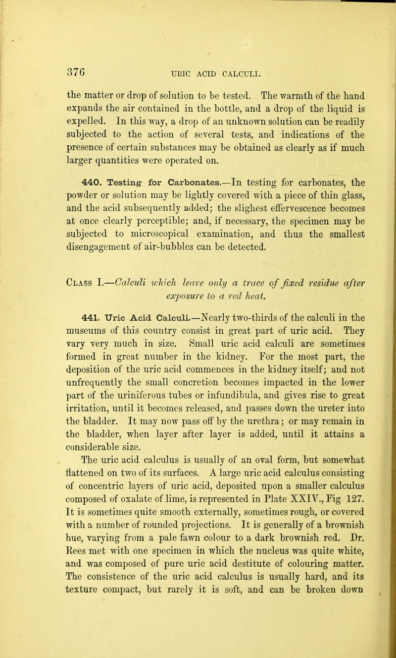 the matter or drop of solution to be tested. The warmth of the hand expands the air contained in the bottle, and a drop of the liquid is expelled. In this way, a drop of an unknown solution can he readily subjected to the action of several tests, and indications of the presence of certain substances may he obtained as clearly as if much larger quantities were operated on. 440. Testing for Carbonates.—In testing for carbonates, the powder or solution may be lightly covered with a piece of thin glass, and the acid subsequently added; the slighest effervescence becomes at once clearly perceptible; and, if necessary, the specimen may be subjected to microscopical examination, and thus the smallest disengagement of air-bubbles can be detected. Class I.—Calculi which leave only a trace of fixed residue after exposure to a red heat. 441. Uric Acid Calculi.—Nearly two-thirds of the calculi in the museums of this country consist in great part of uric acid. They vary very much in size. Small uric acid calculi are sometimes formed in great number in the kidney. For the most part, the deposition of the uric acid commences in the kidney itself; and not unfrequently the small concretion becomes impacted in the lower part of the uriniferous tubes or infundibula, and gives rise to great irritation, until it becomes released, and passes down the ureter into the bladder. It may now pass off by the urethra; or may remain in the bladder, when layer after layer is added, until it attains a considerable size. The uric acid calculus is usually of an oval form, but somewhat flattened on two of its surfaces. A large uric acid calculus consisting of concentric layers of uric acid, deposited upon a smaller calculus composed of oxalate of lime, is represented in Plate XXIV., Fig 127. It is sometimes quite smooth externally, sometimes rough, or covered with a number of rounded projections. It is generally of a brownish hue, varying from a pale fawn colour to a dark brownish red. Dr. Rees met with one specimen in which the nucleus was quite white, and was composed of pure uric acid destitute of colouring matter. The consistence of the uric acid calculus is usually hard, and its texture compact, but rarely it is soft, and can be broken down