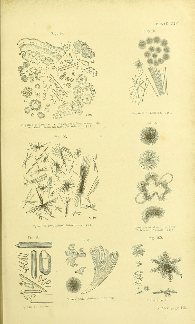 Fig. 94. Fig. 96. Tyrosine, crystallised from water, i 16-’ Fig. 95. Crystals of Leucine, f> 161. Fisr. 97. Fig. 99. Stearic rid. Robin and 1 erdeii Fig. ICO. Margaric acid.